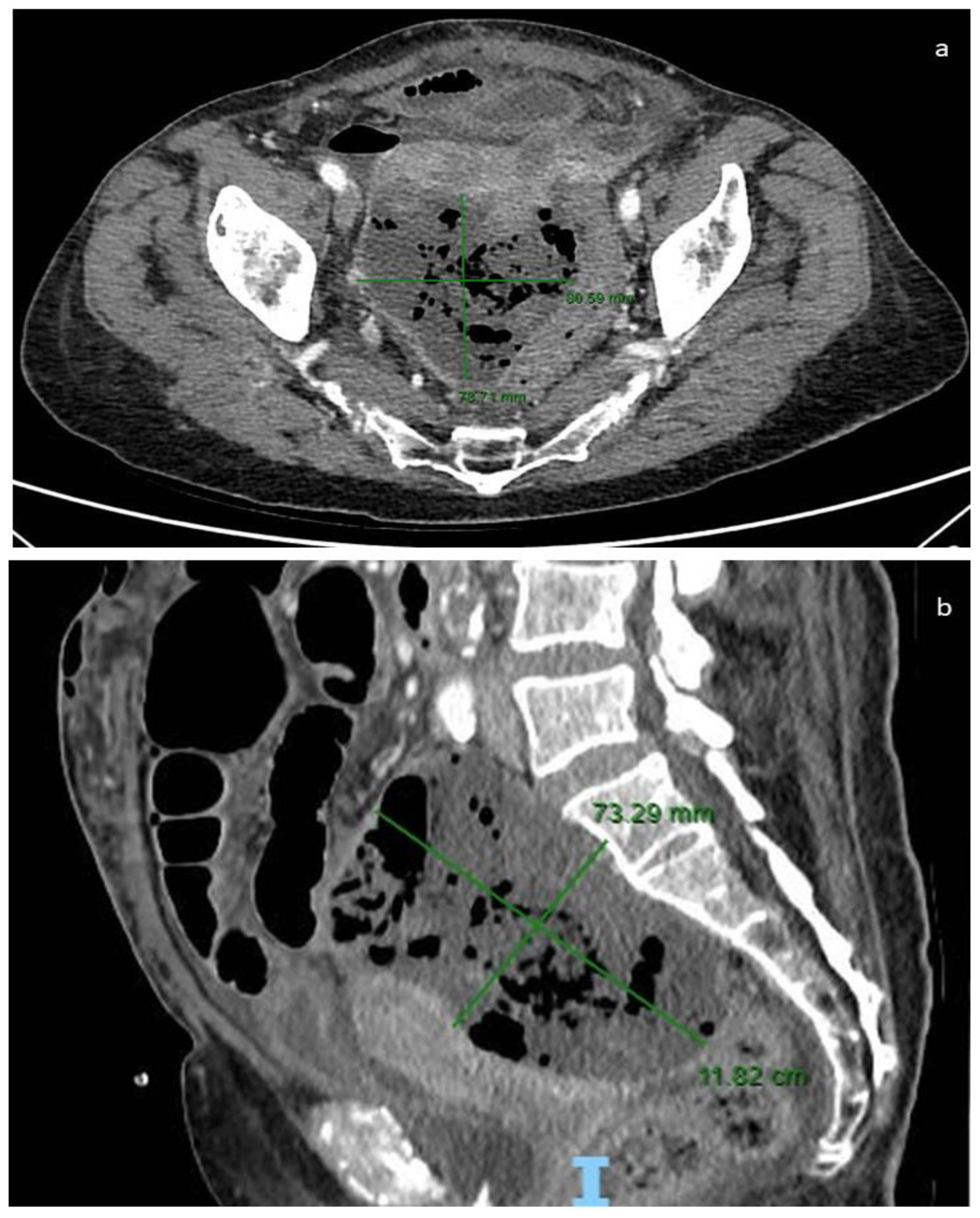 Cancers 16 02305 g003