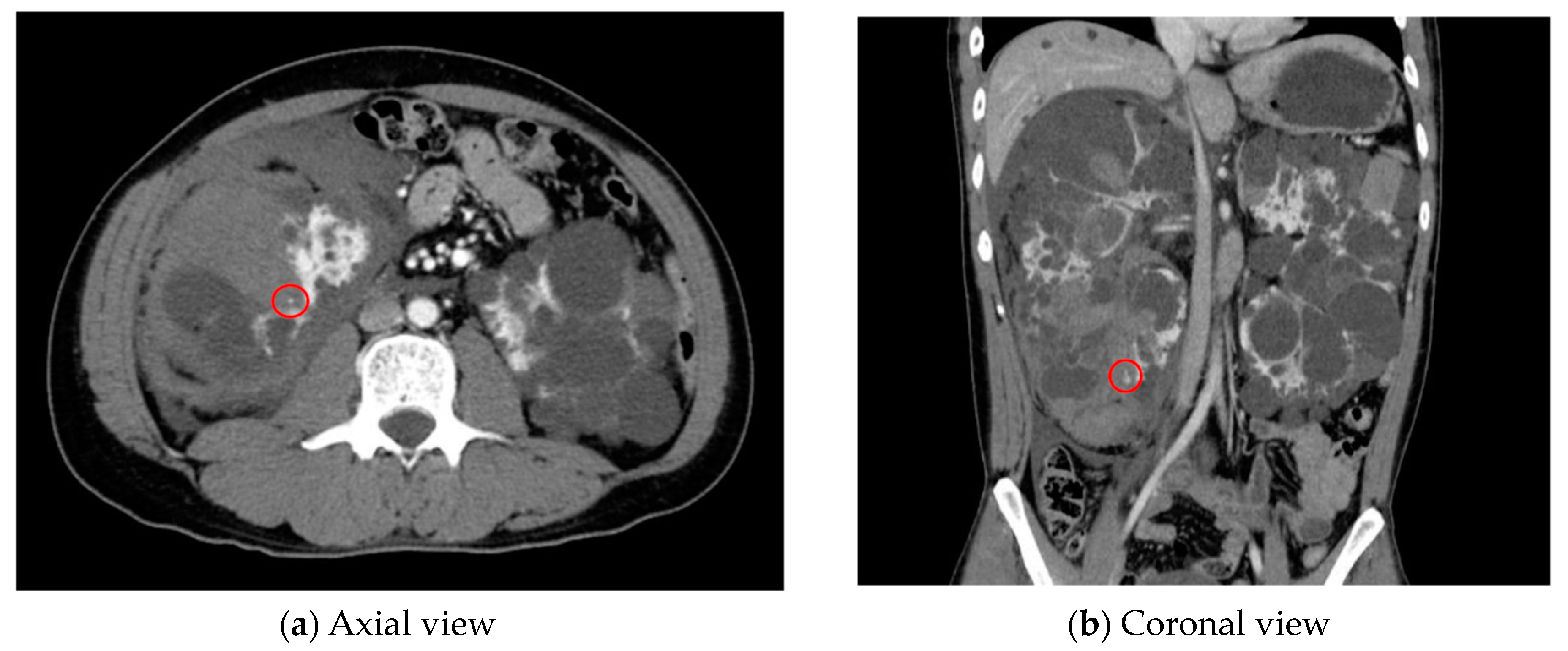 Cancers 16 02308 g001