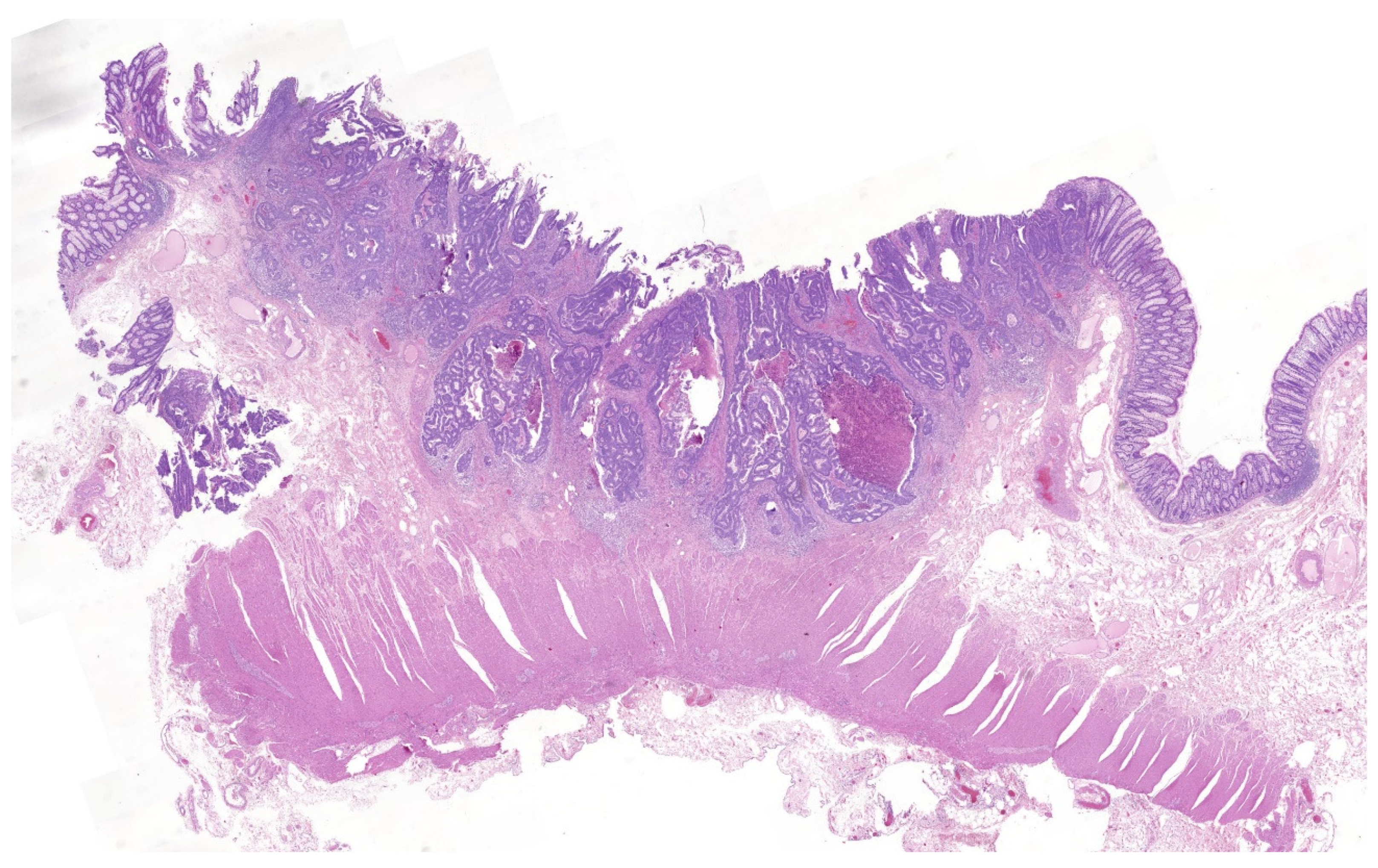 Cancers 16 02321 g001