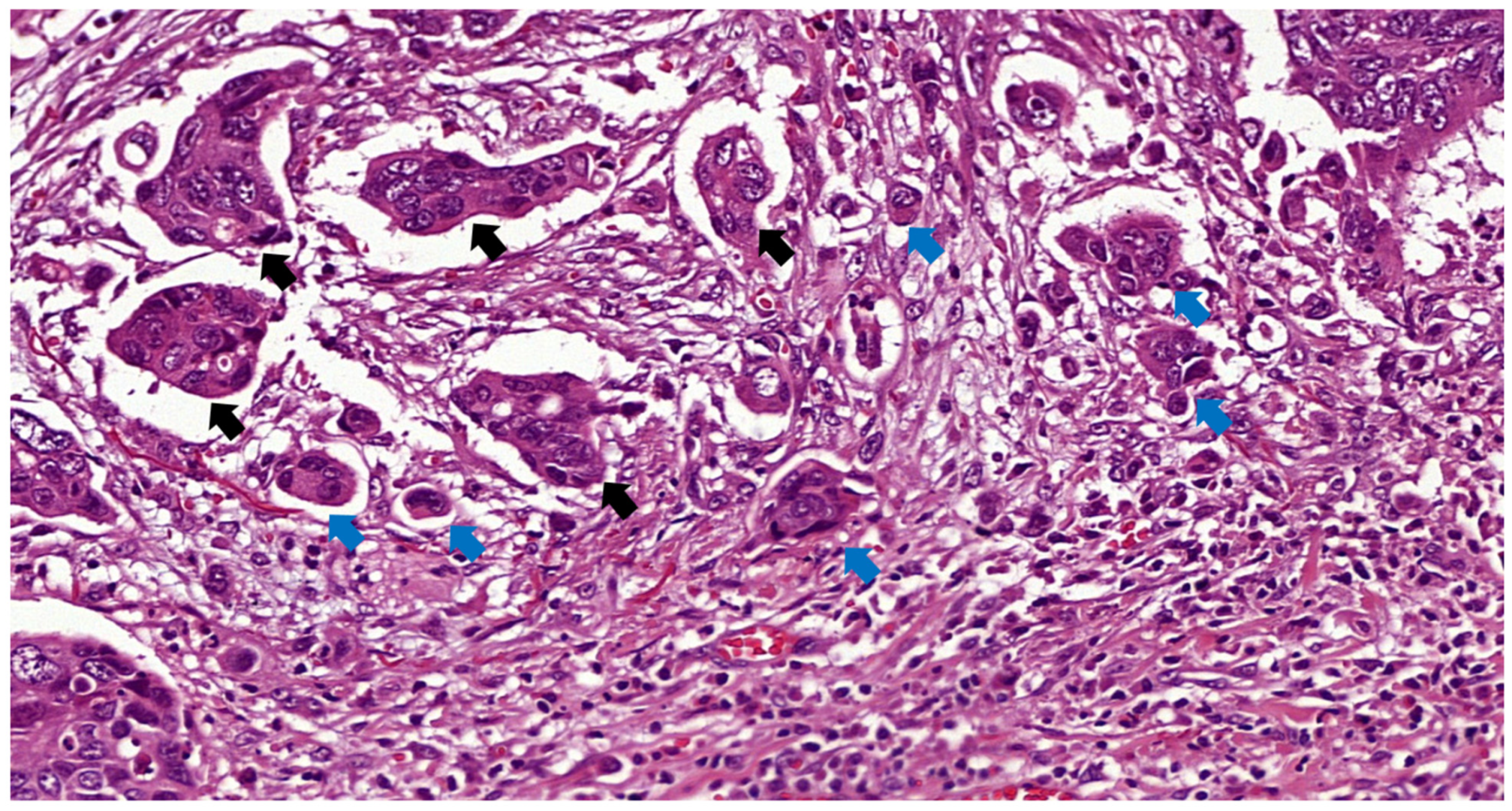 Cancers 16 02321 g002