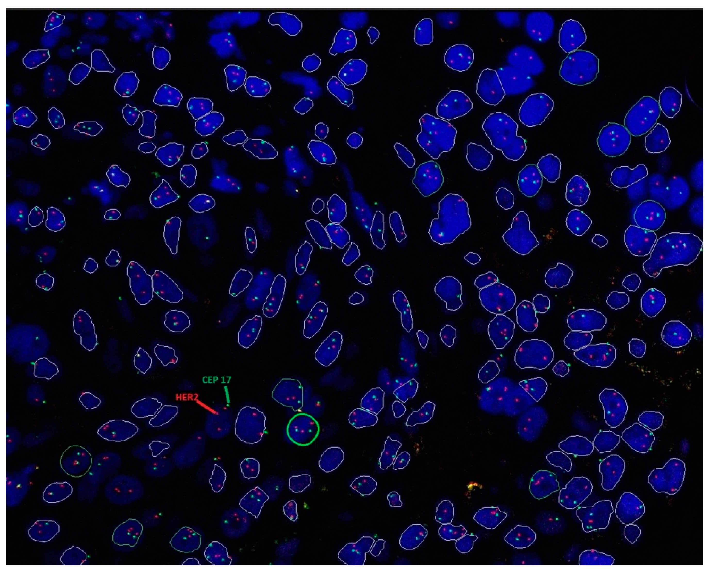 Cancers 16 02325 g002 Cancers 16 02325 g002