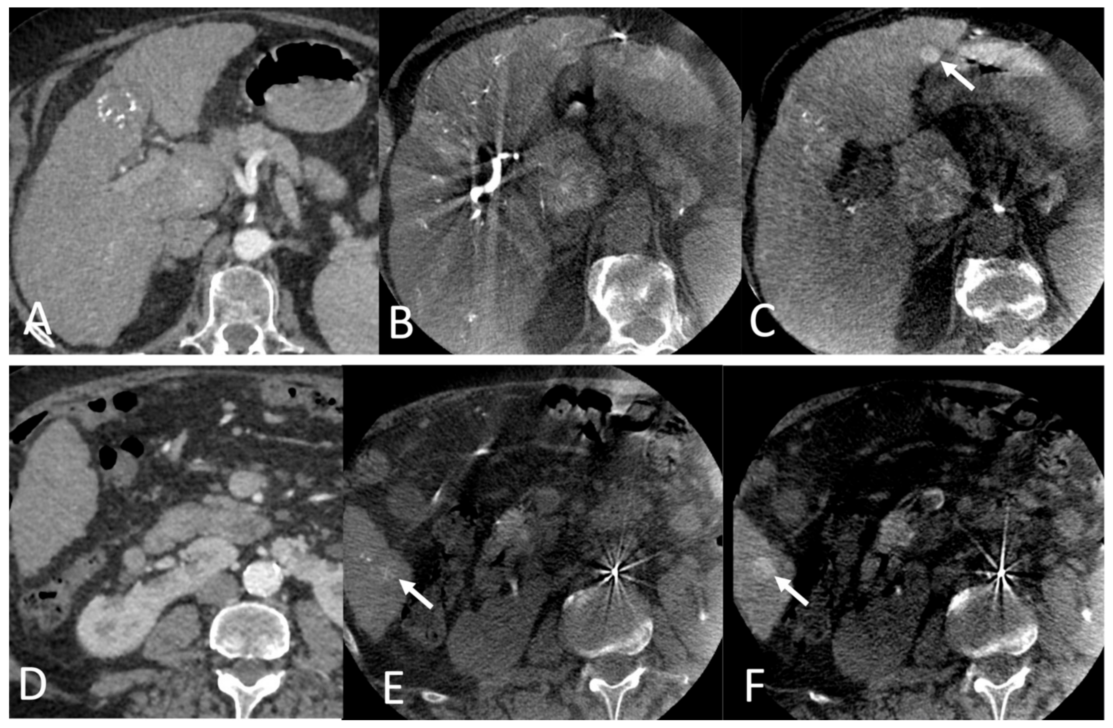 Cancers 16 02333 g002