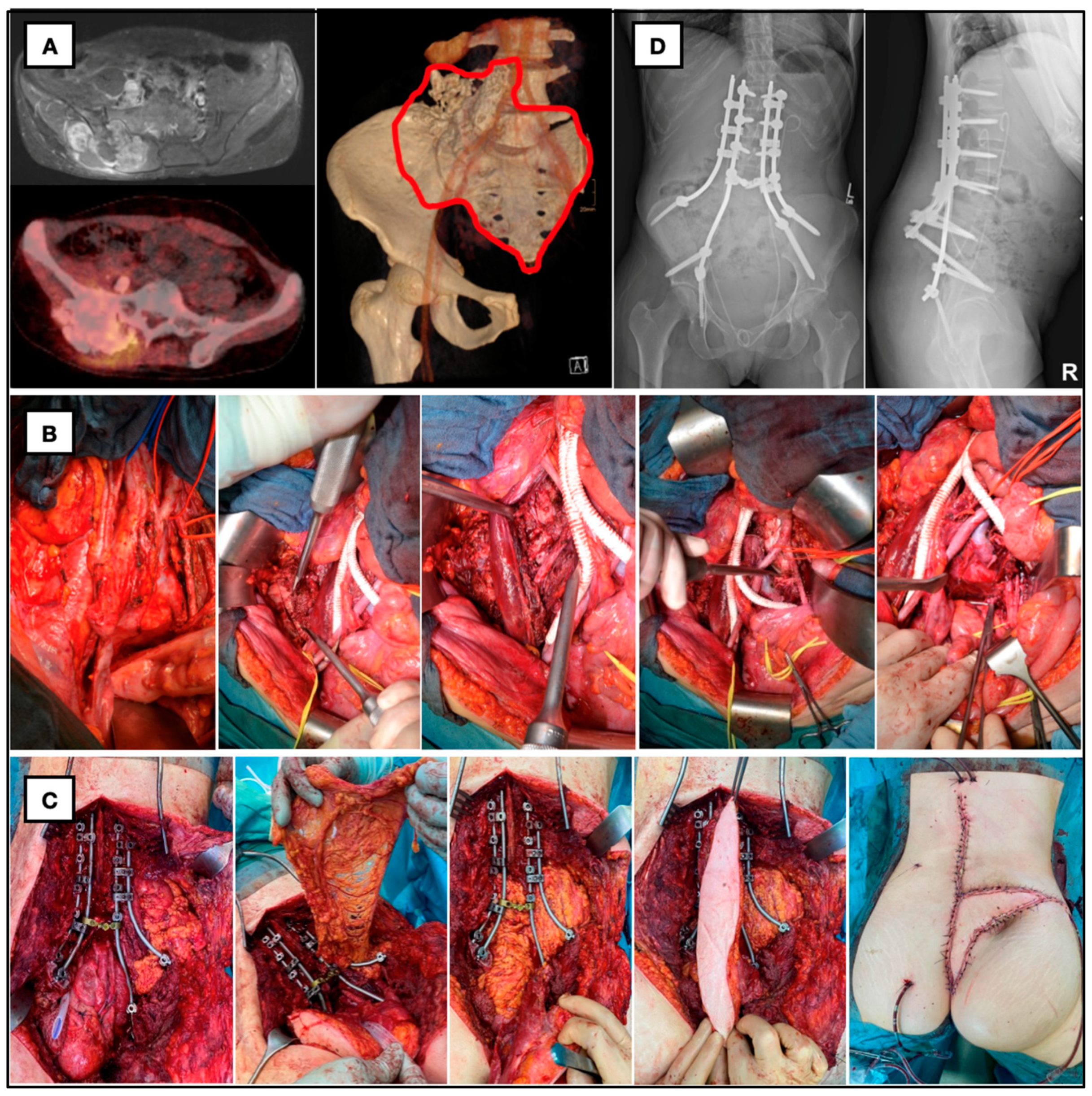 Cancers 16 02334 g001 Cancers 16 02334 g001