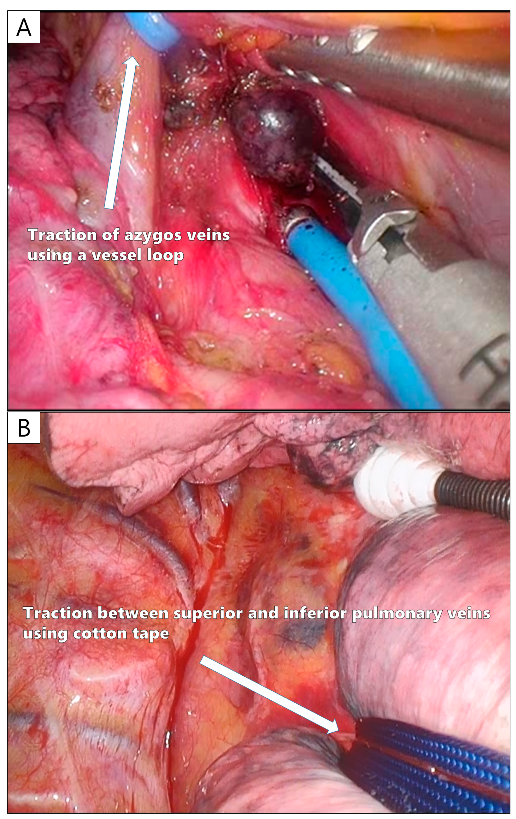 Cancers 16 02343 g005