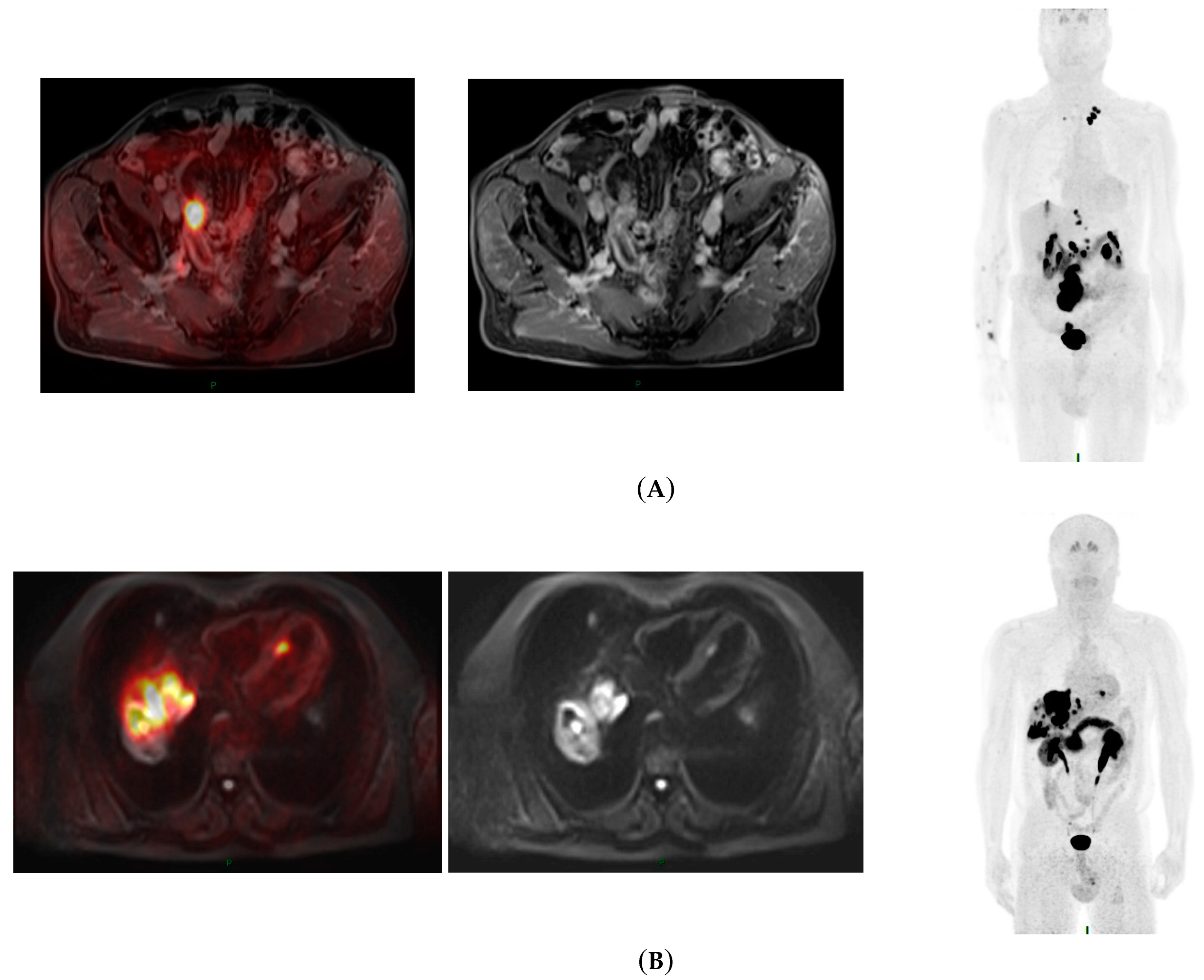 Cancers 16 02372 g002