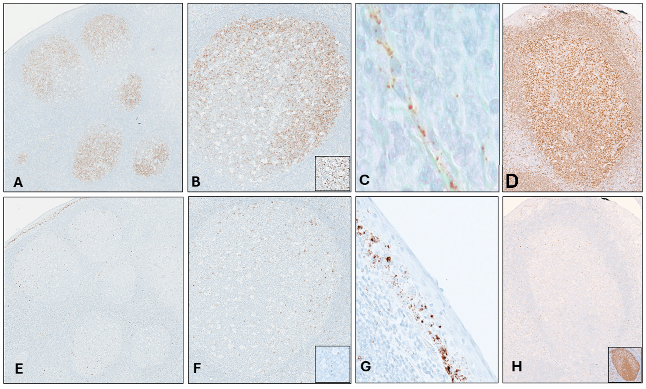 Cancers 16 02378 g003