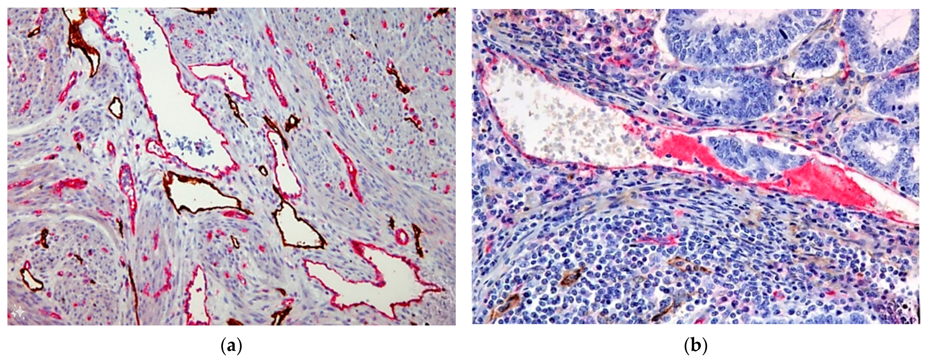 Cancers 16 02385 g002