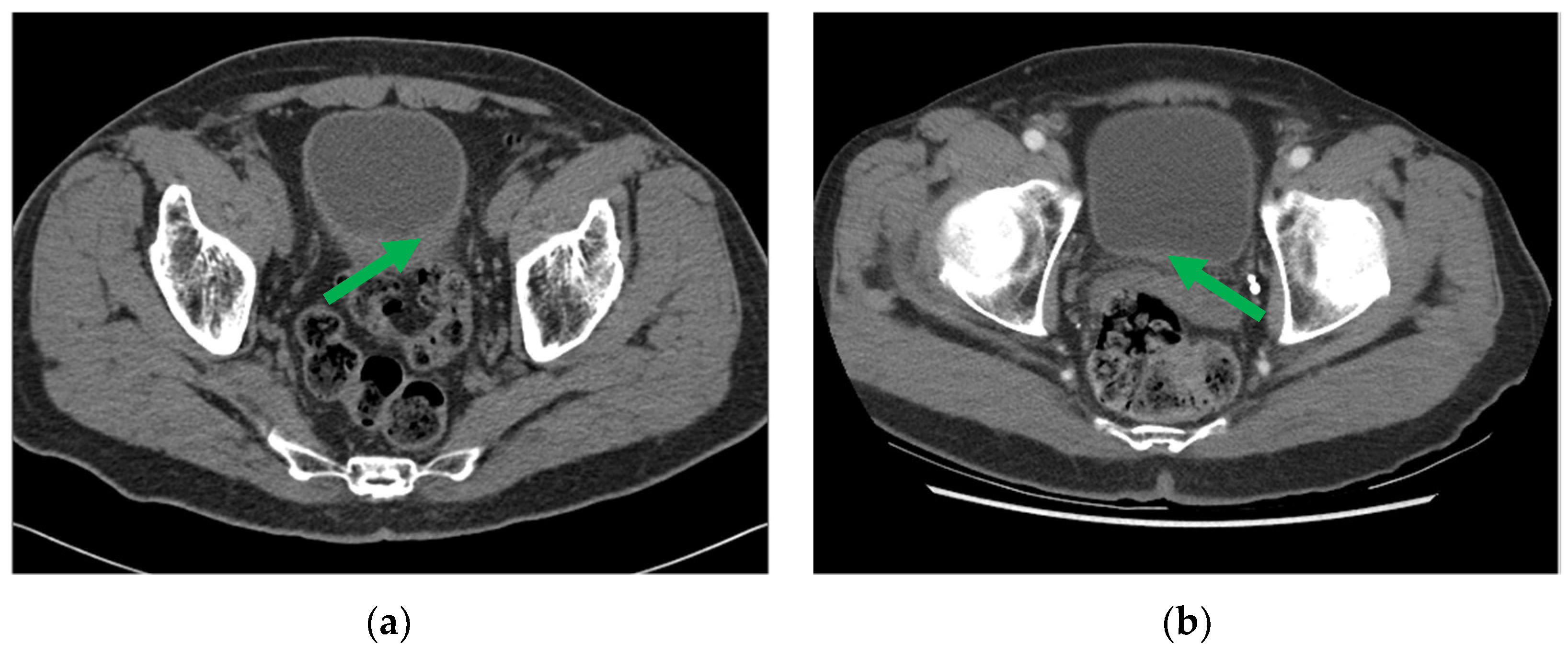 Cancers 16 02402 g003