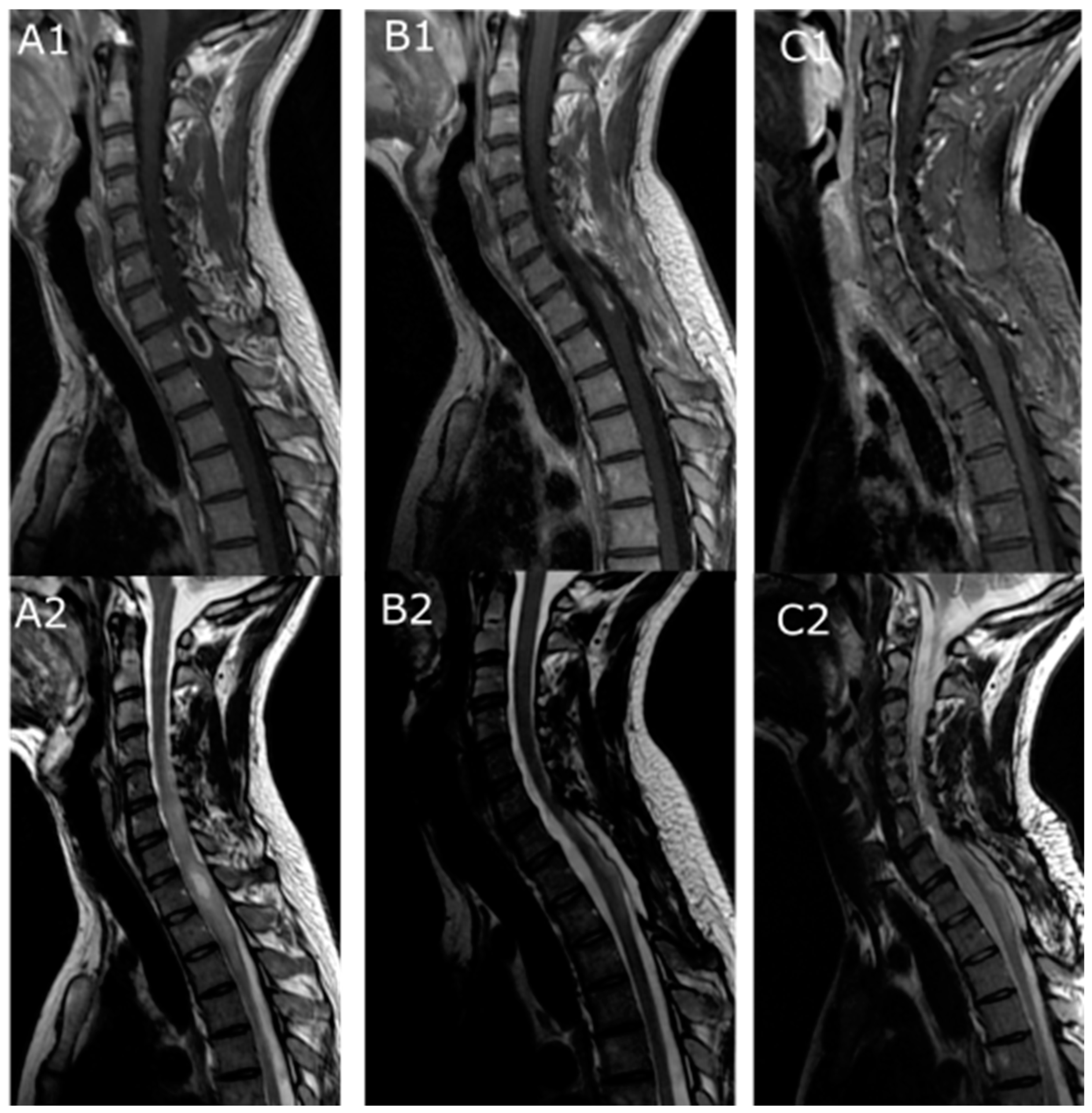 Cancers 16 02417 g002