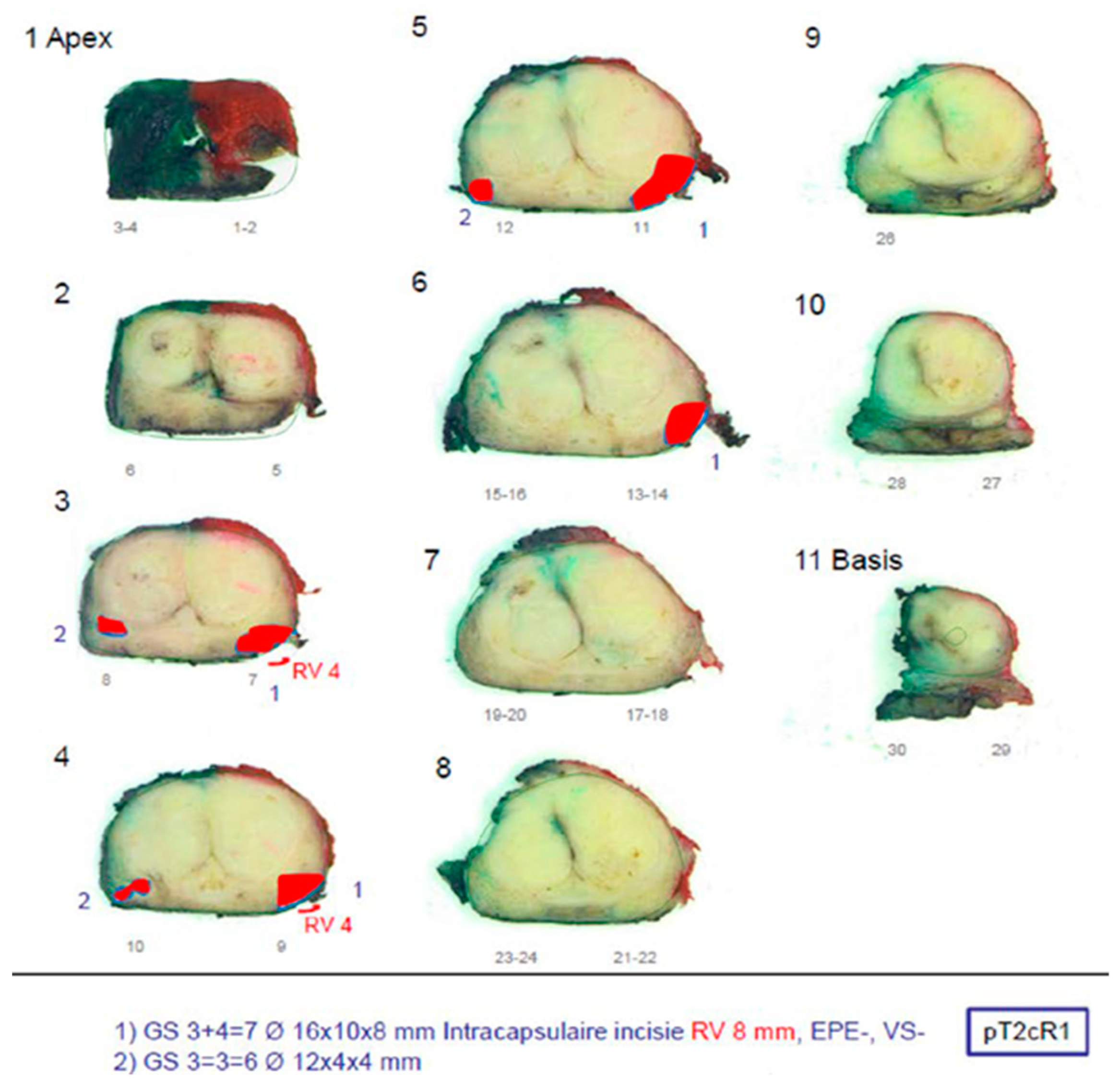 Cancers 16 02431 g002