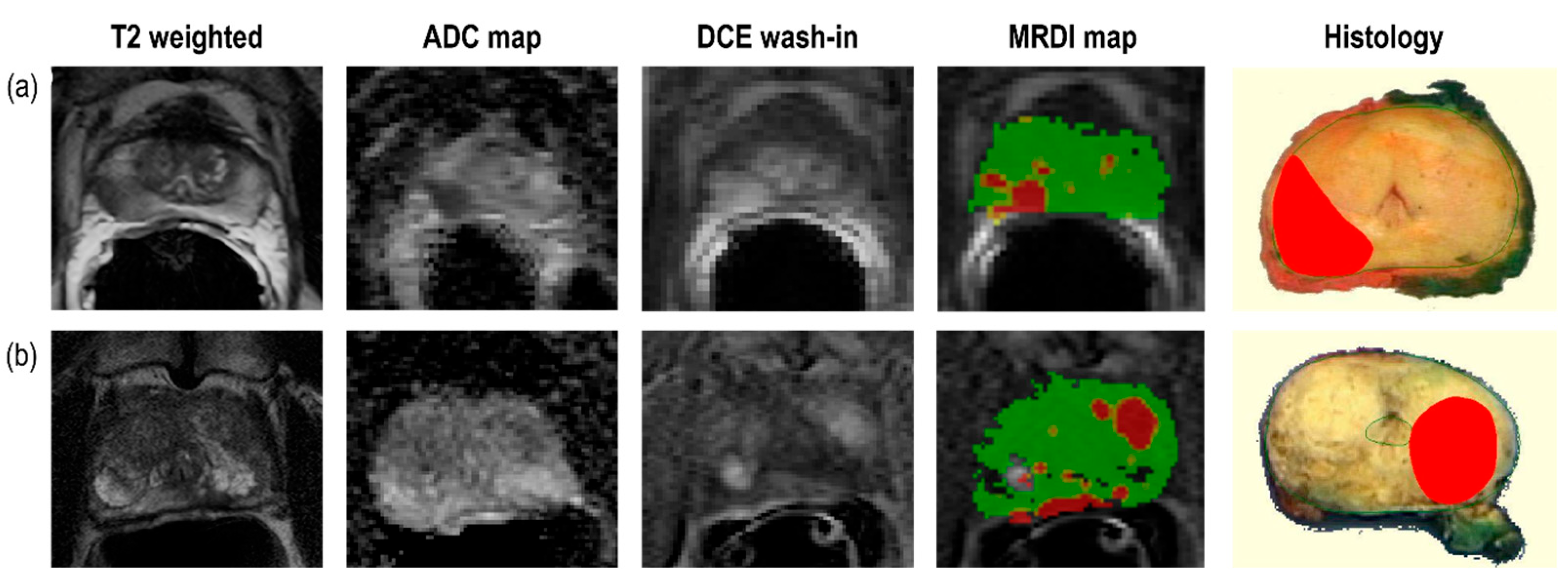 Cancers 16 02431 g004