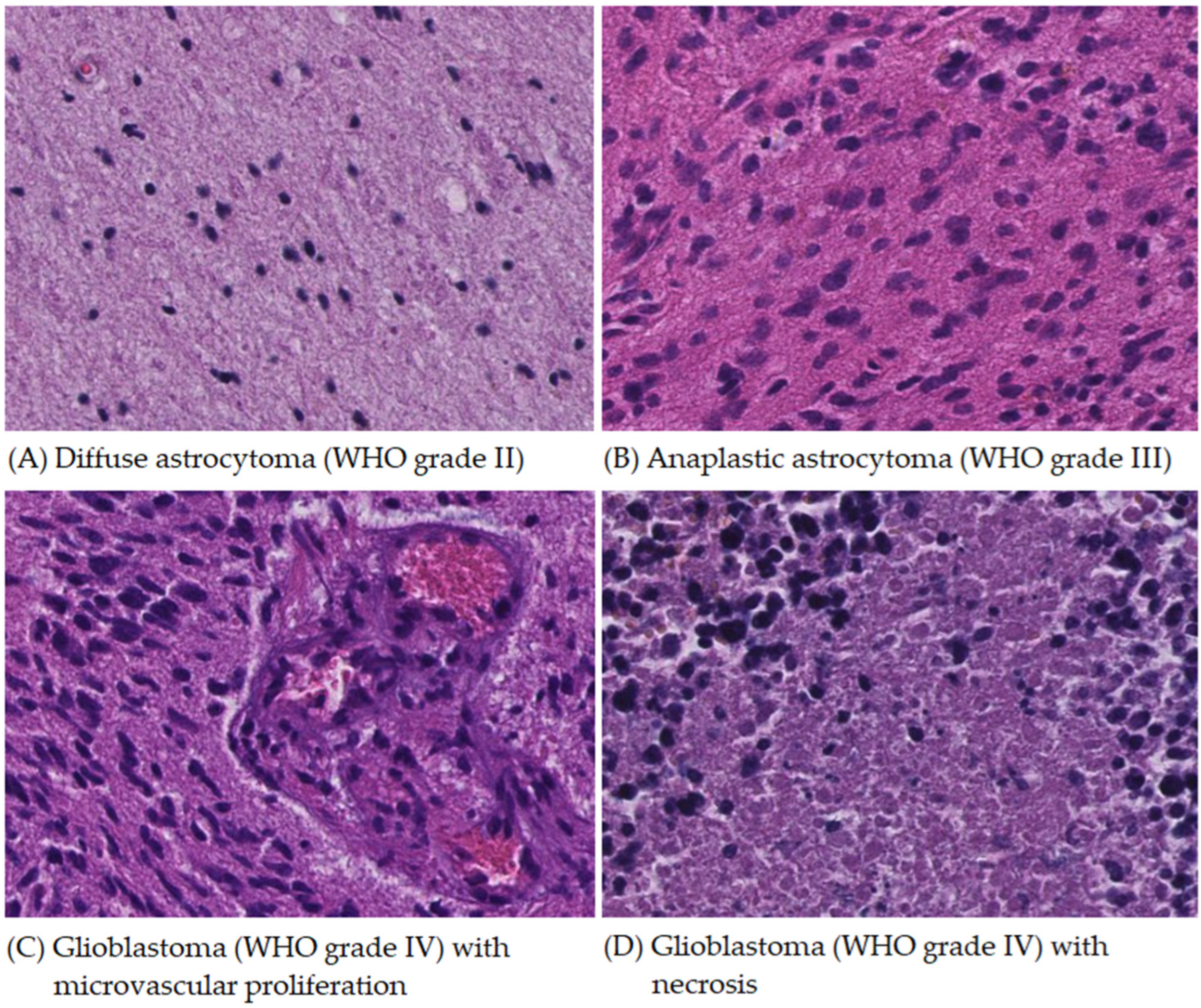 Cancers 16 02449 g001