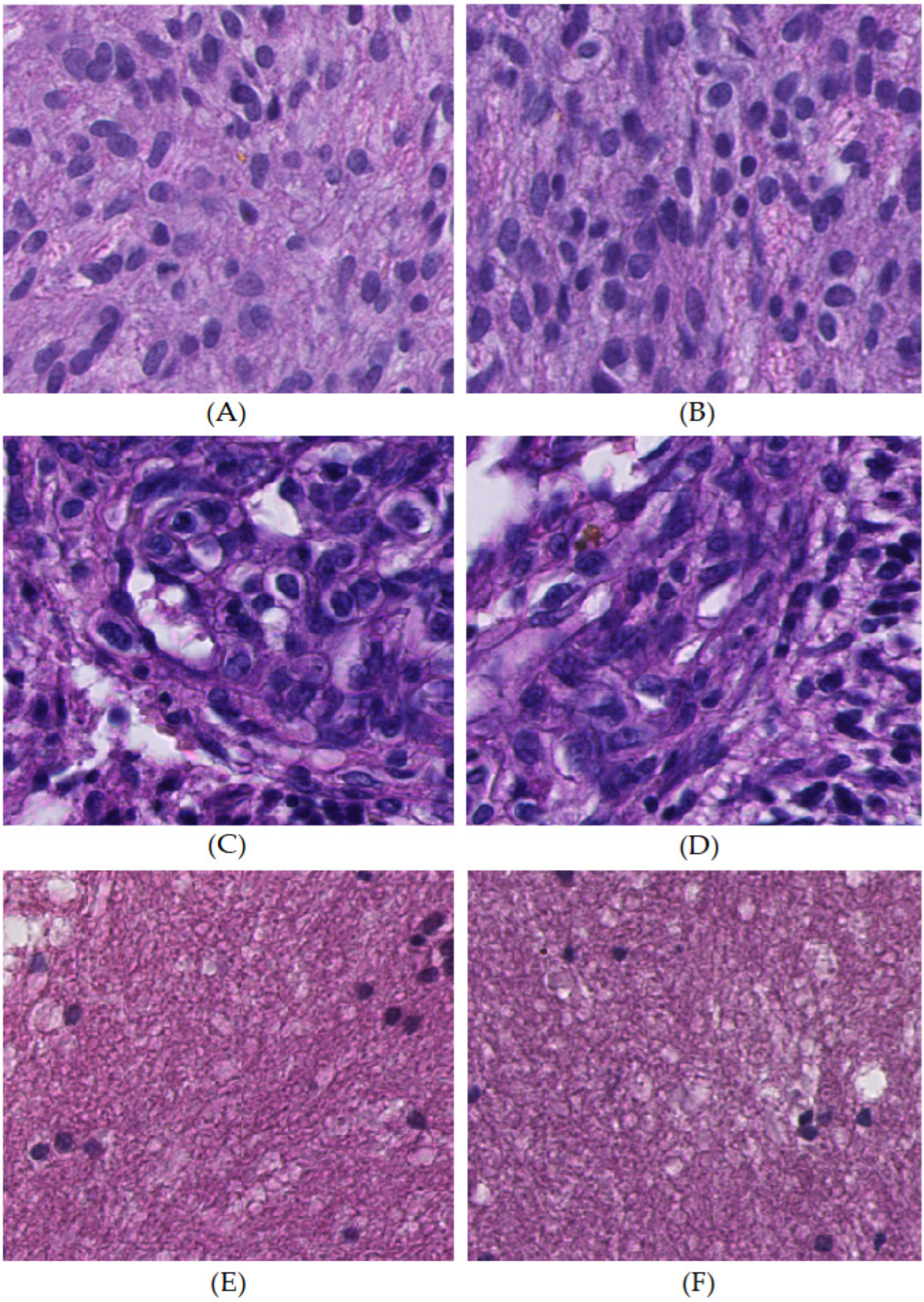 Cancers 16 02449 g011