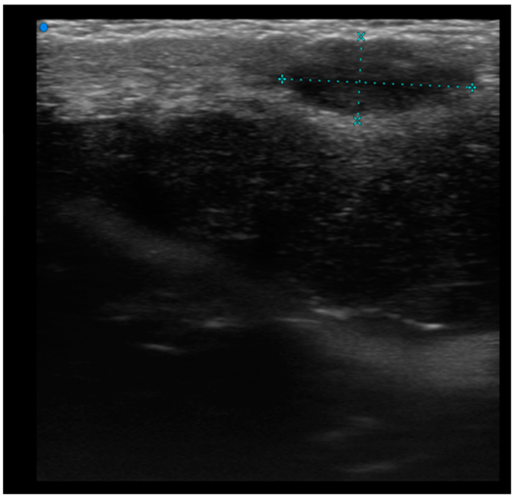 Cancers 16 02456 g002