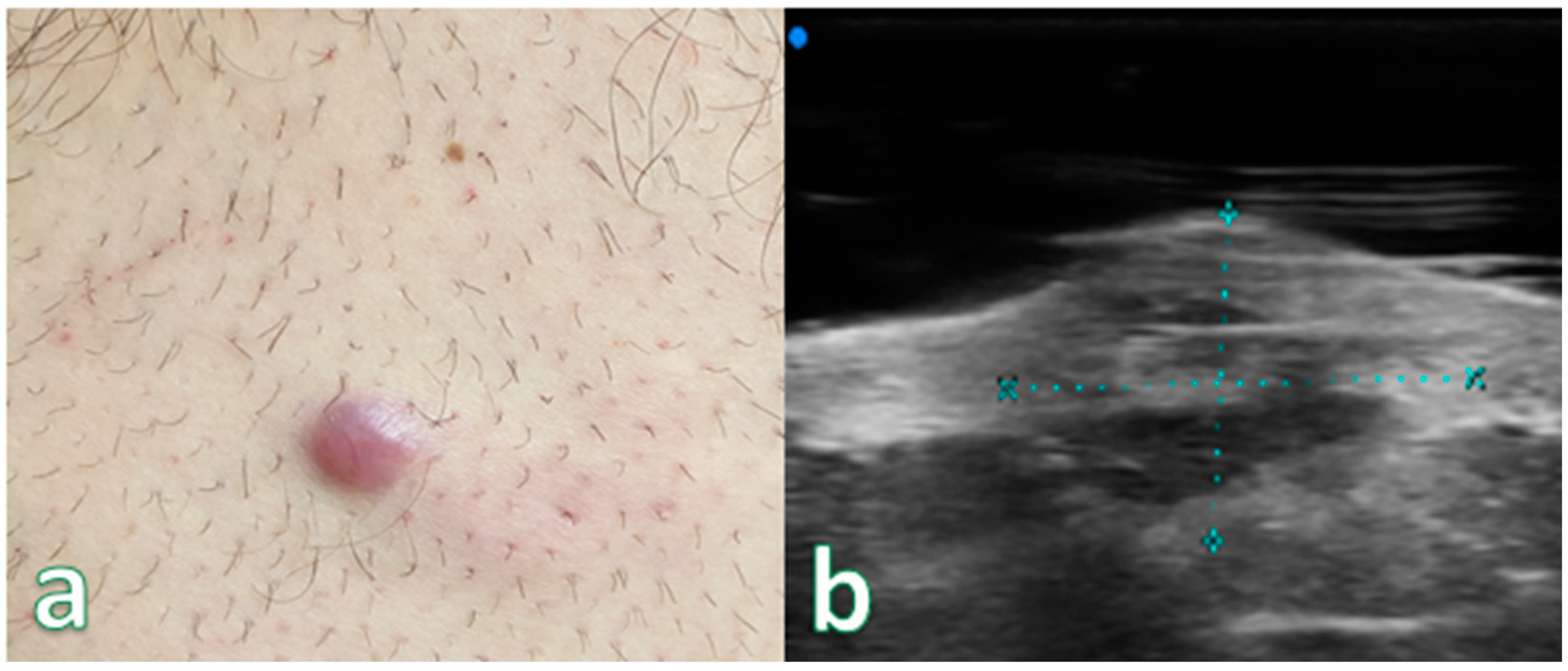 Cancers 16 02456 g003