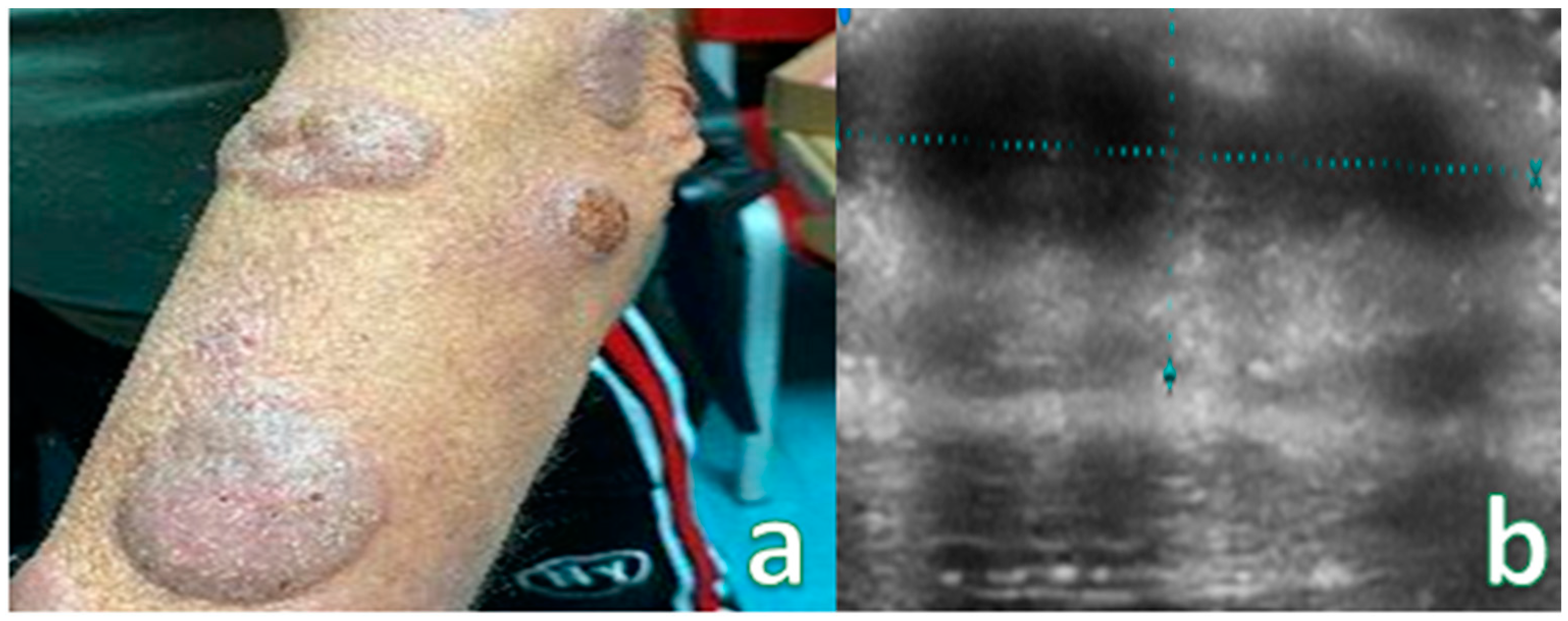 Cancers 16 02456 g006