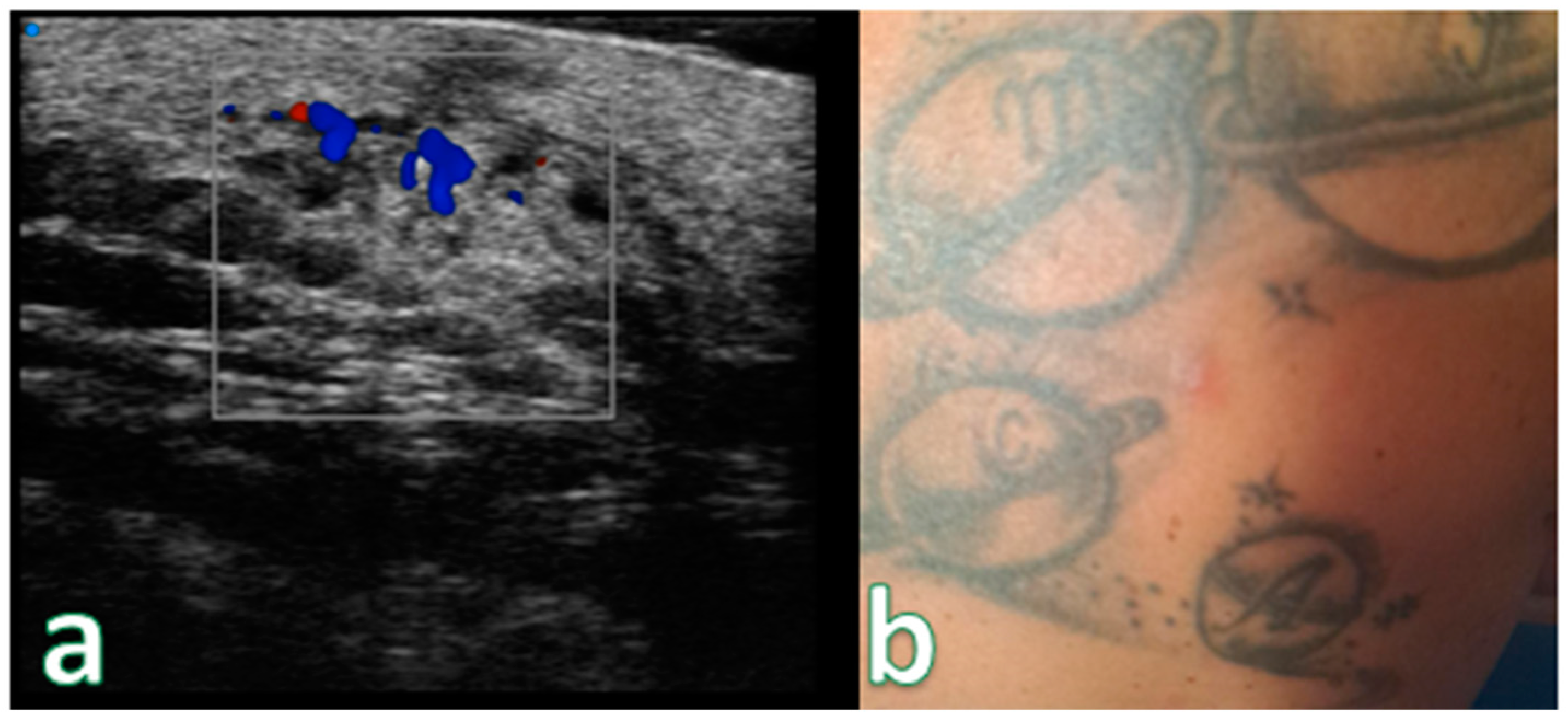 Cancers 16 02456 g008