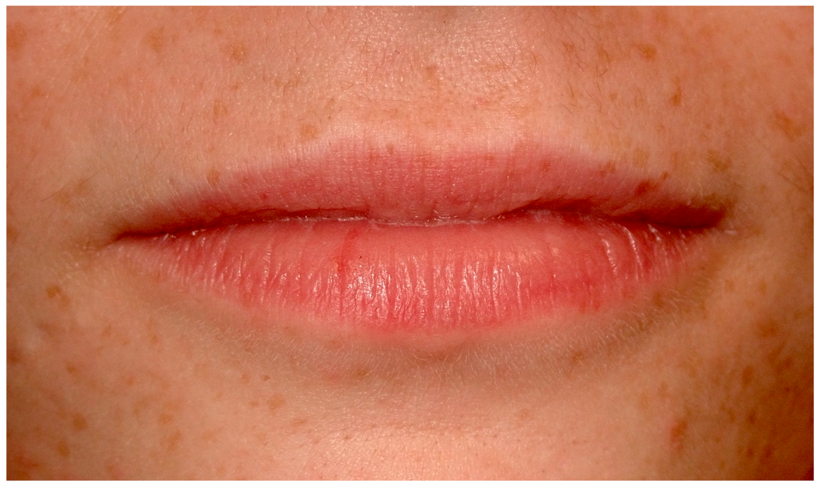 Cancers 16 02487 g001