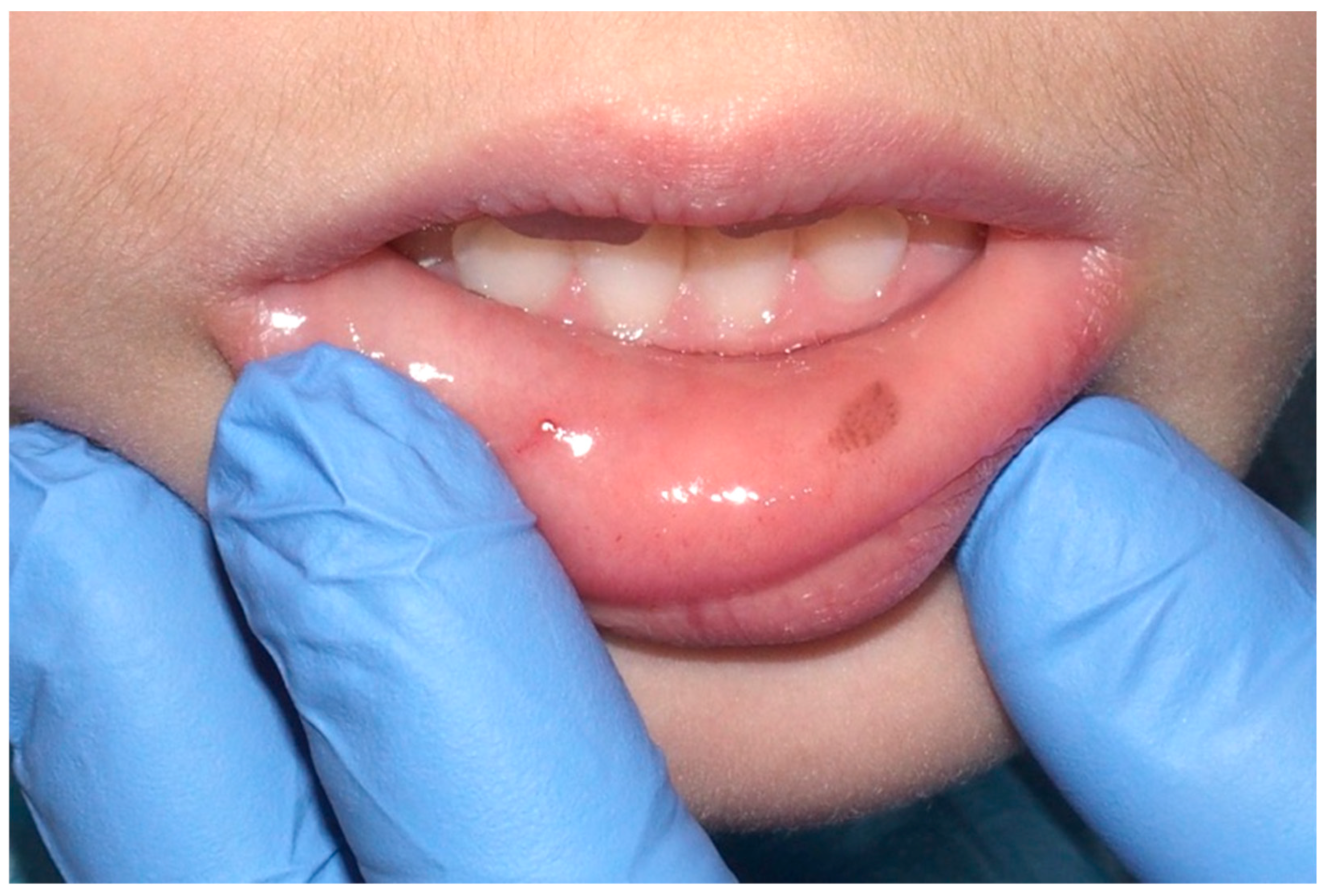 Cancers 16 02487 g002