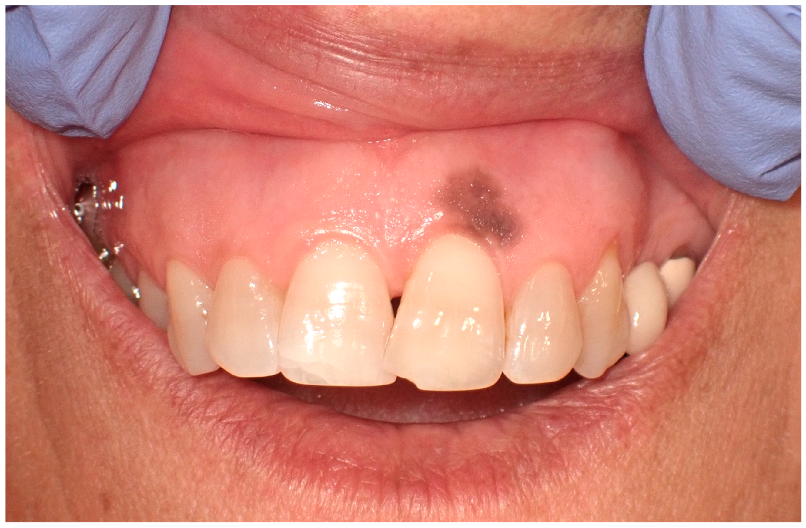 Cancers 16 02487 g003