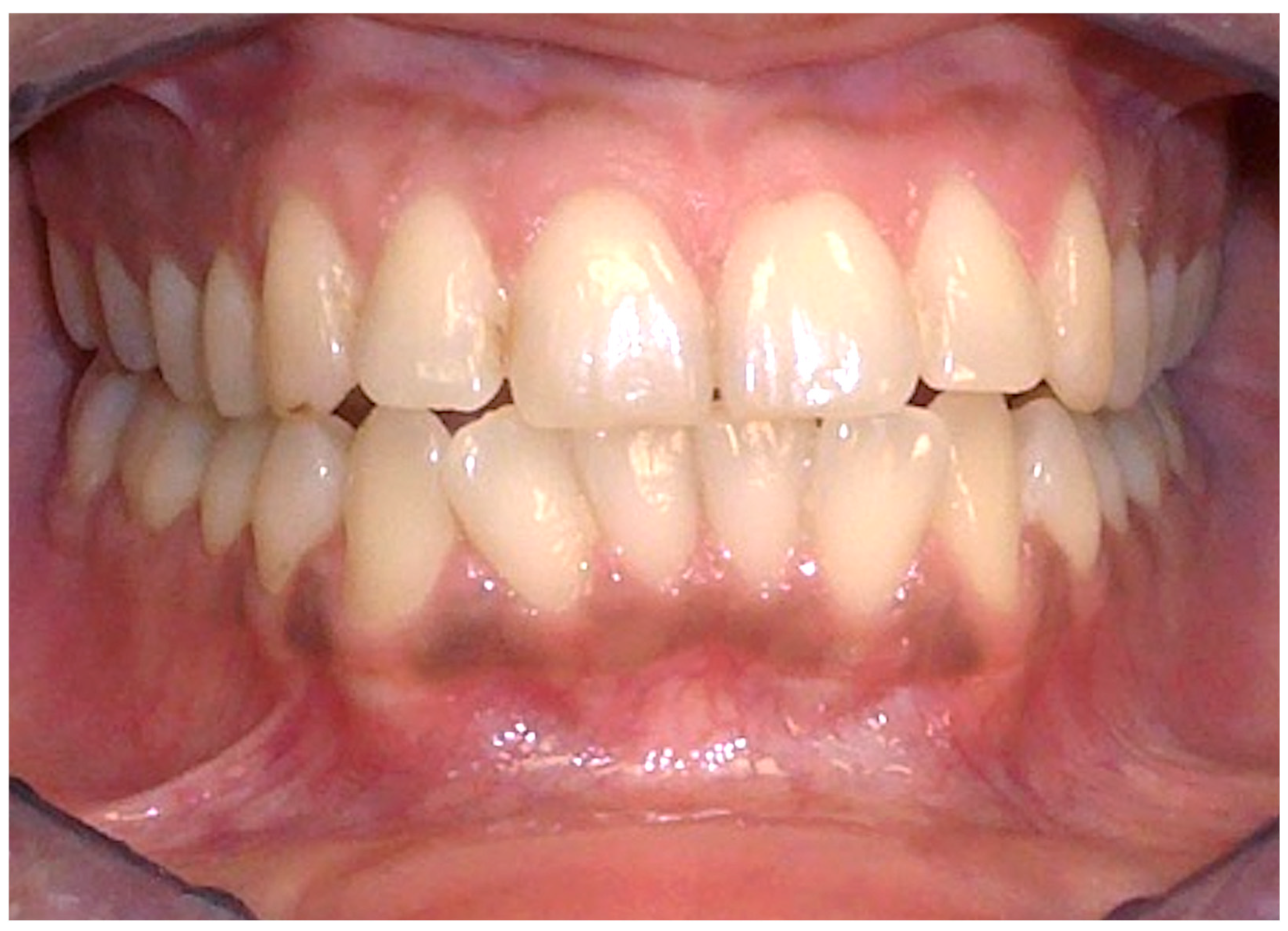 Cancers 16 02487 g006