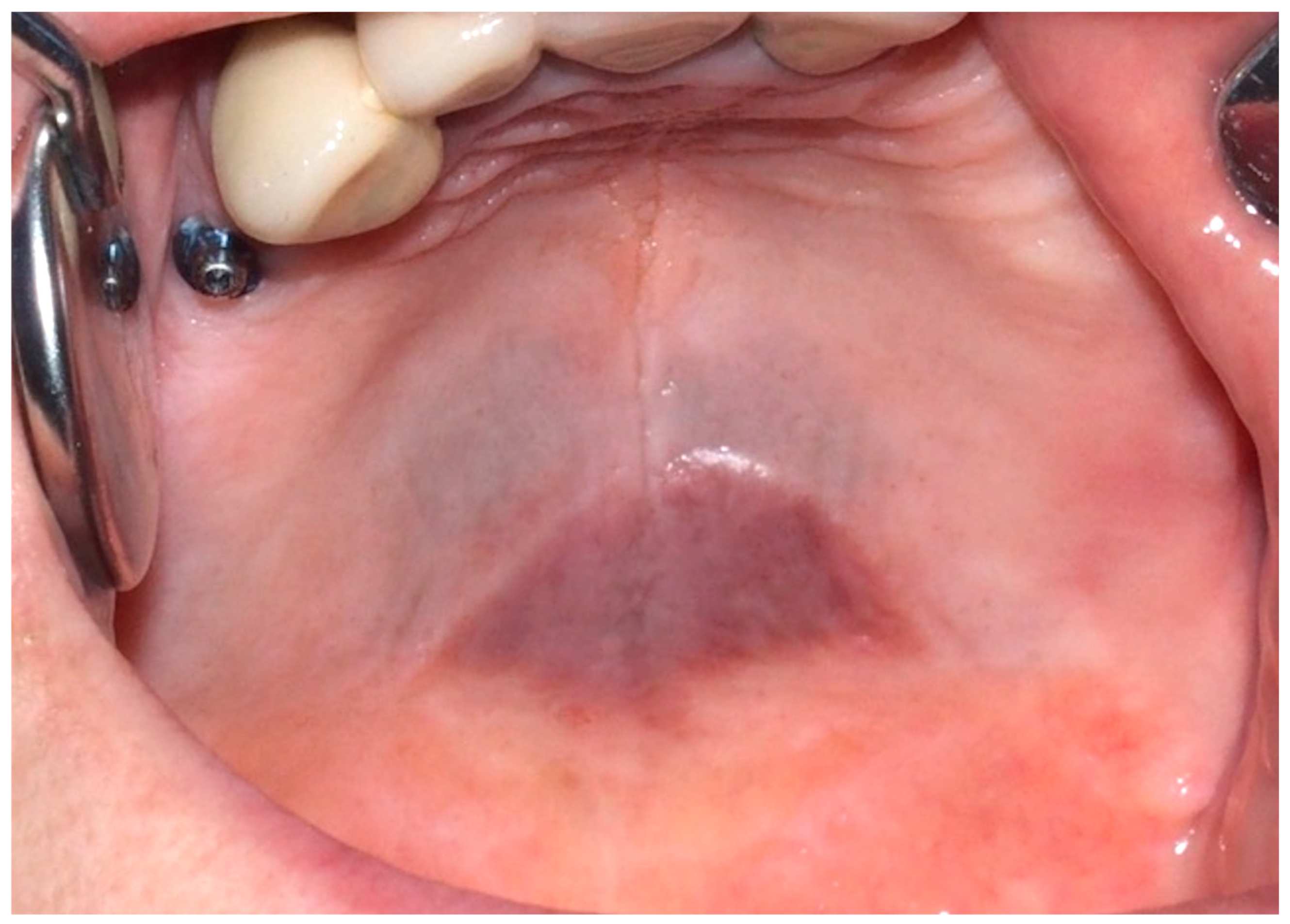 Cancers 16 02487 g007