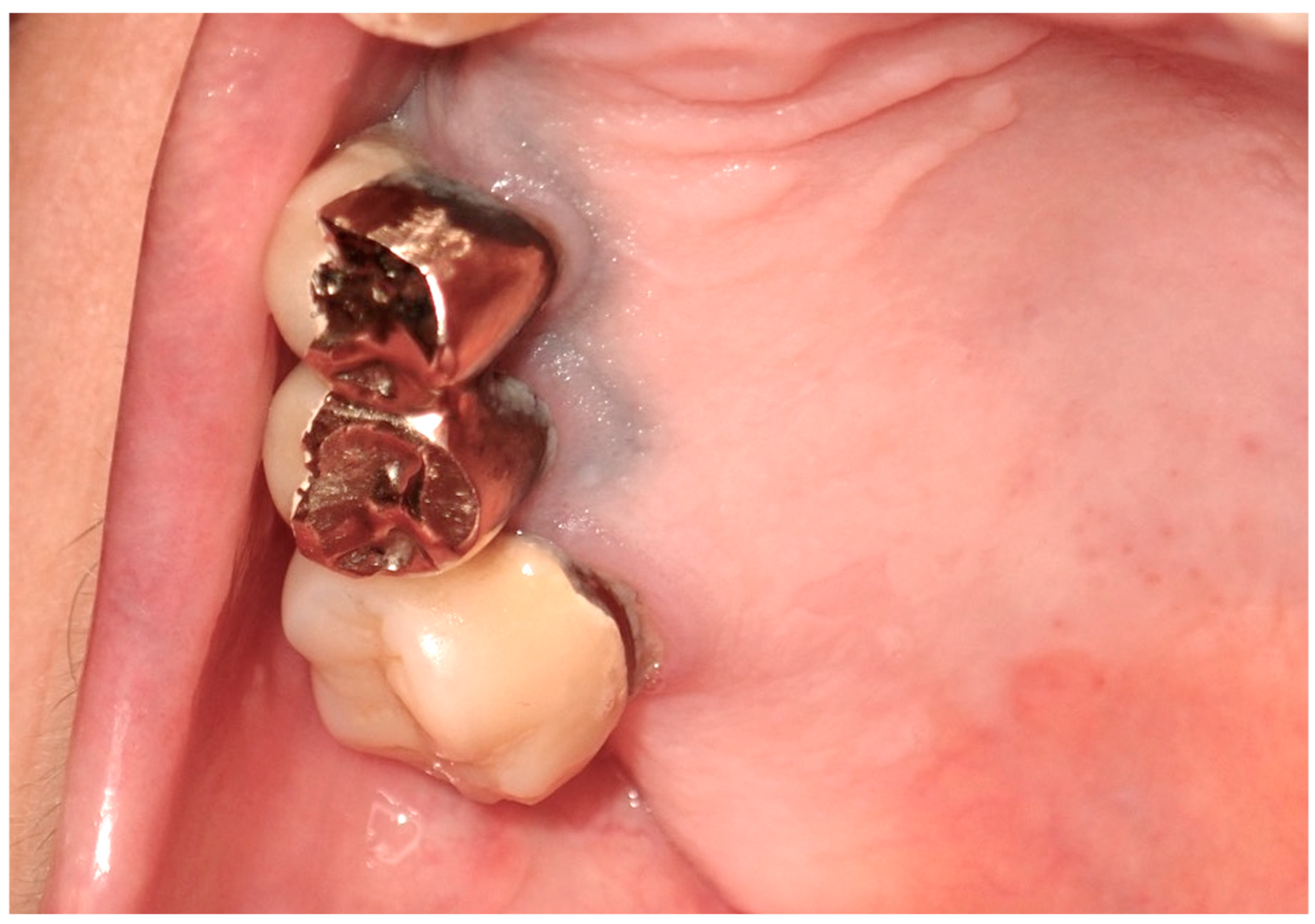 Cancers 16 02487 g008