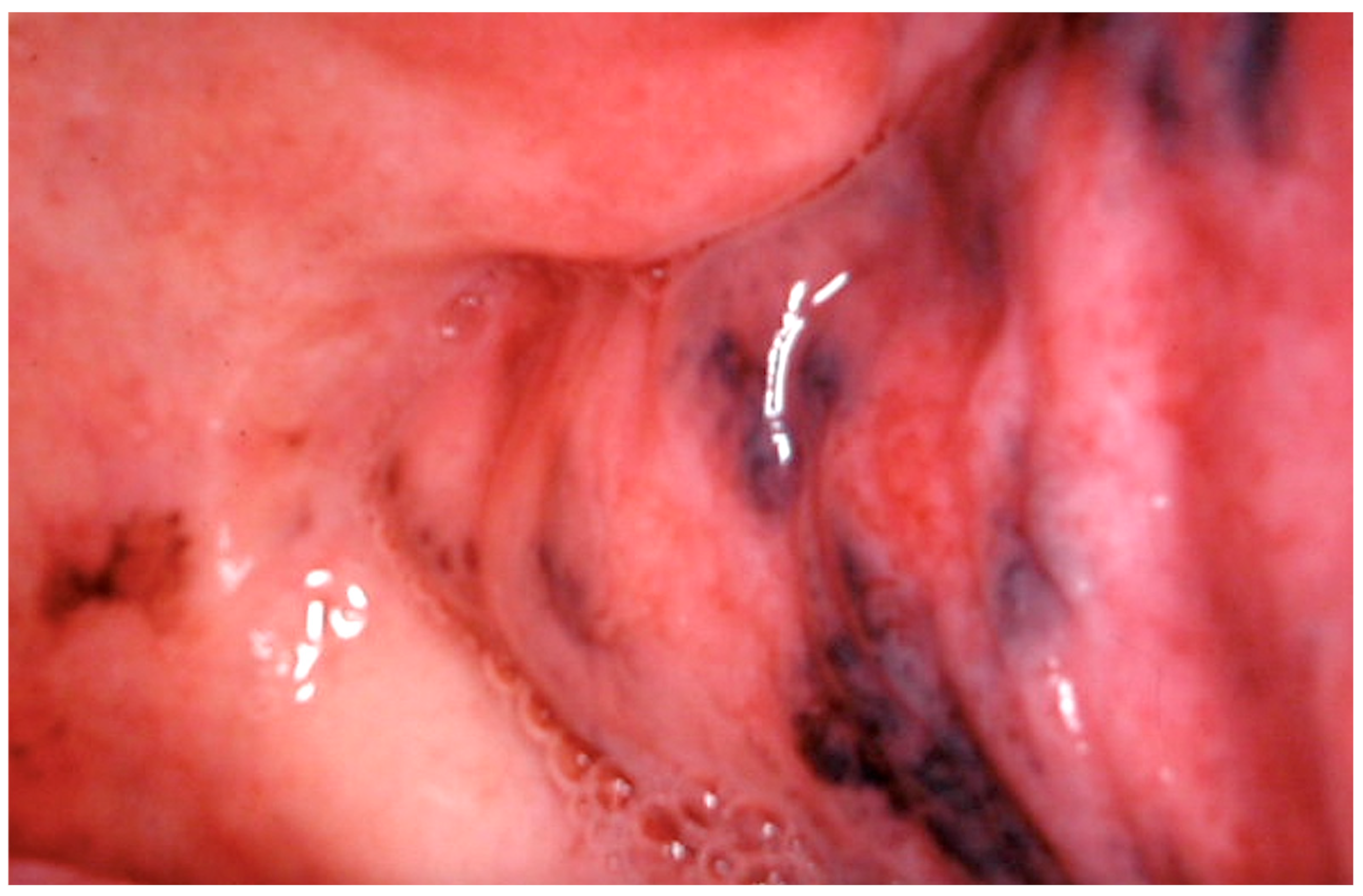 Cancers 16 02487 g009