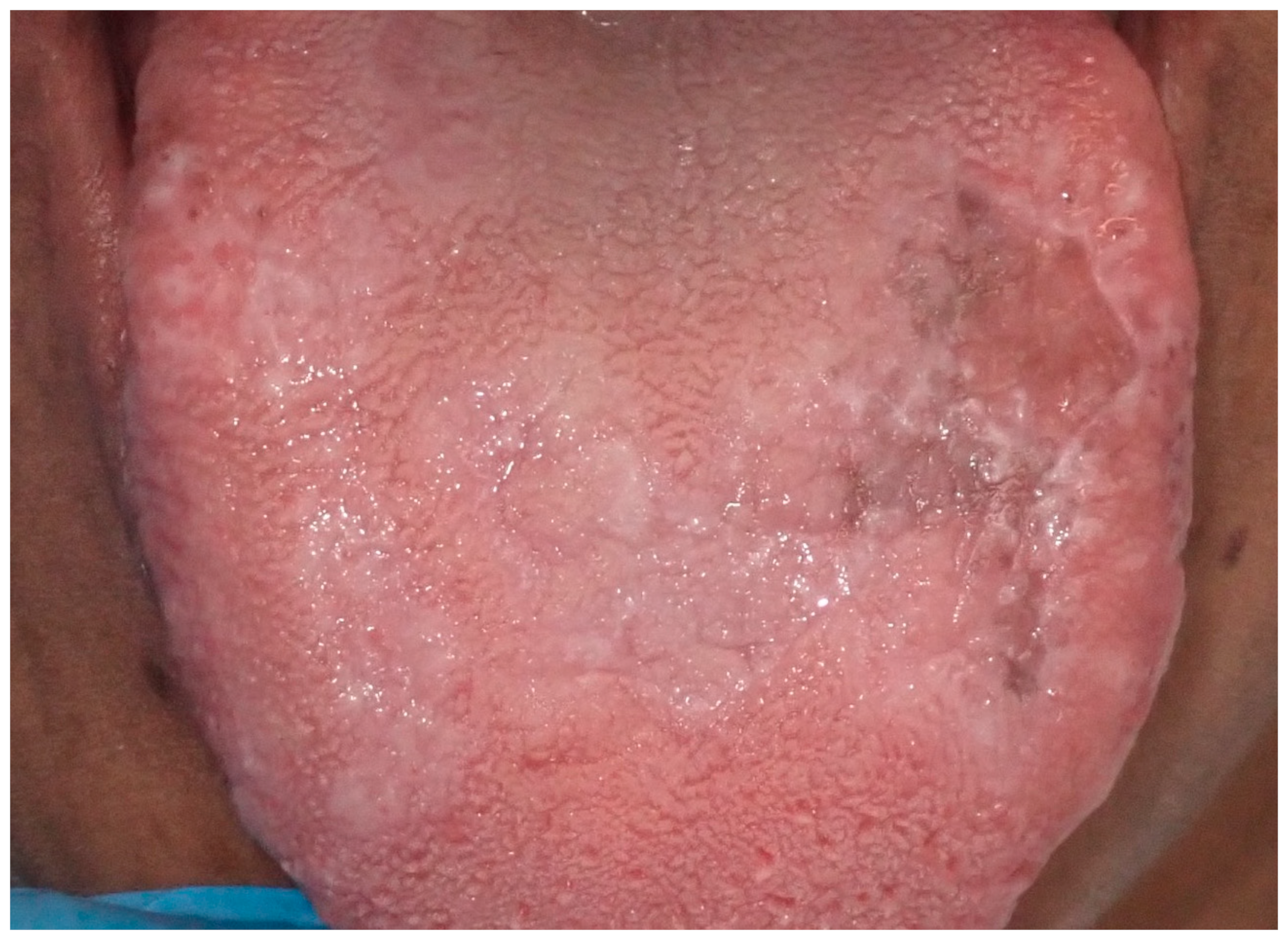 Cancers 16 02487 g012