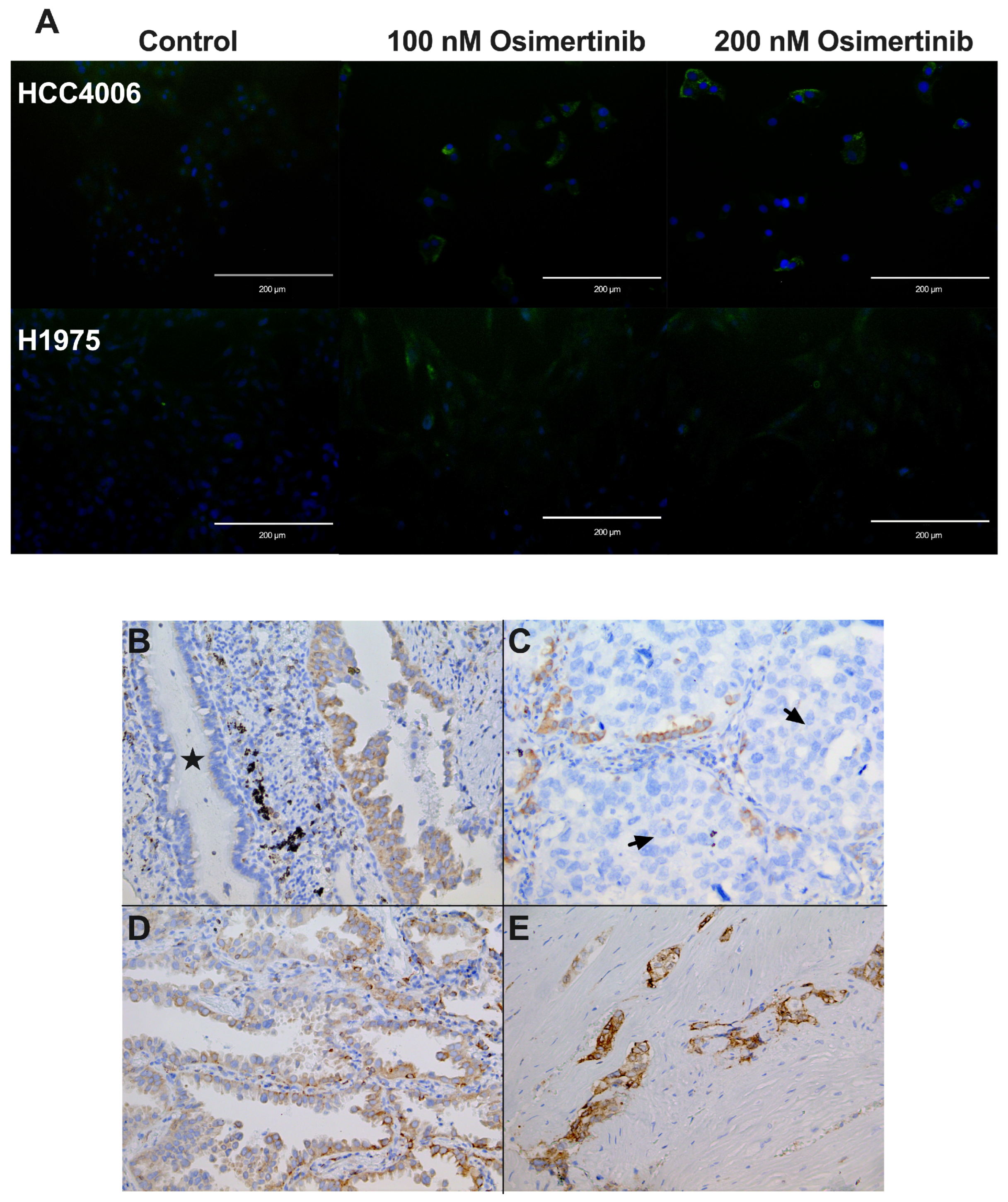 Cancers 16 02490 g007