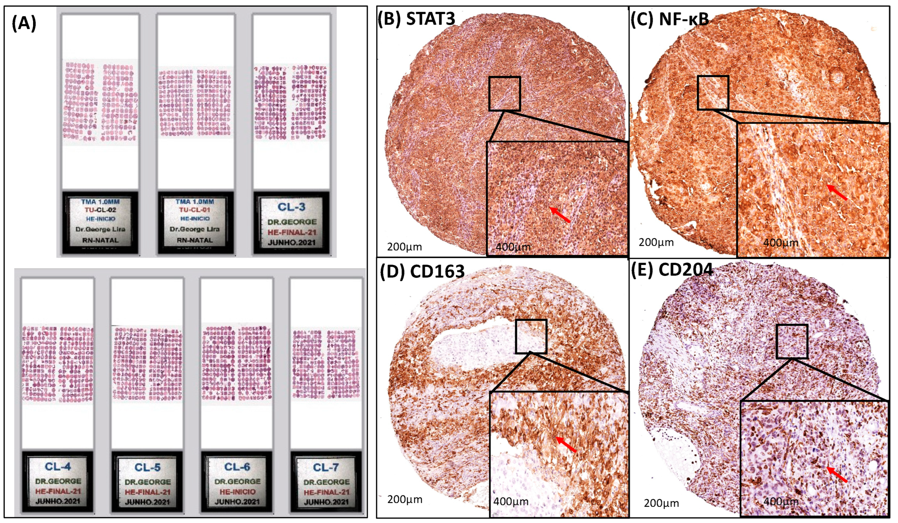Cancers 16 02496 g002 Cancers 16 02496 g002