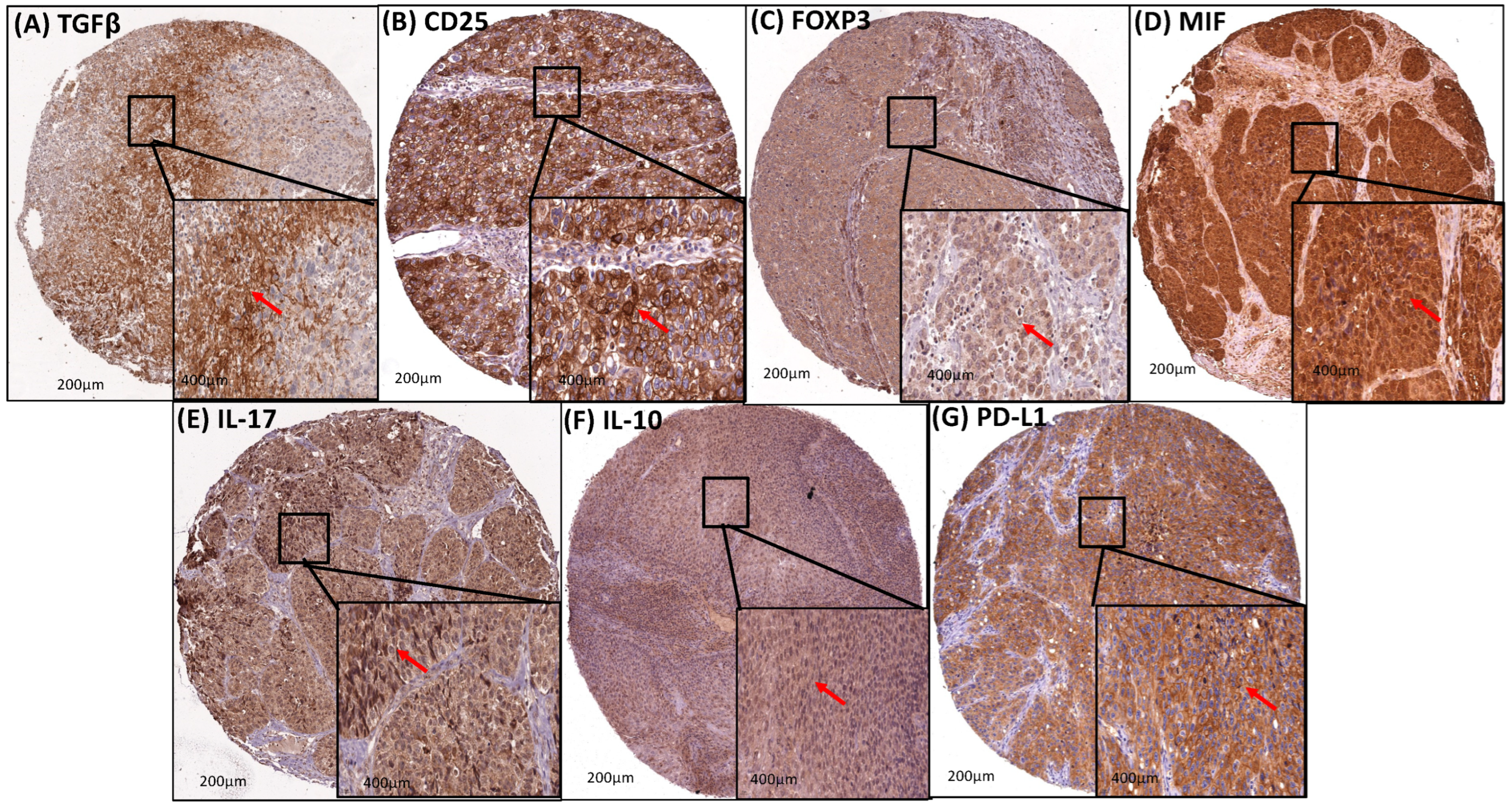 Cancers 16 02496 g004 Cancers 16 02496 g004