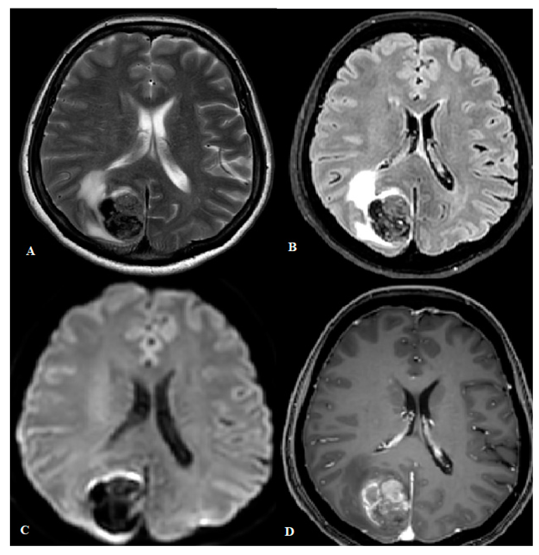 Cancers 16 02508 g002