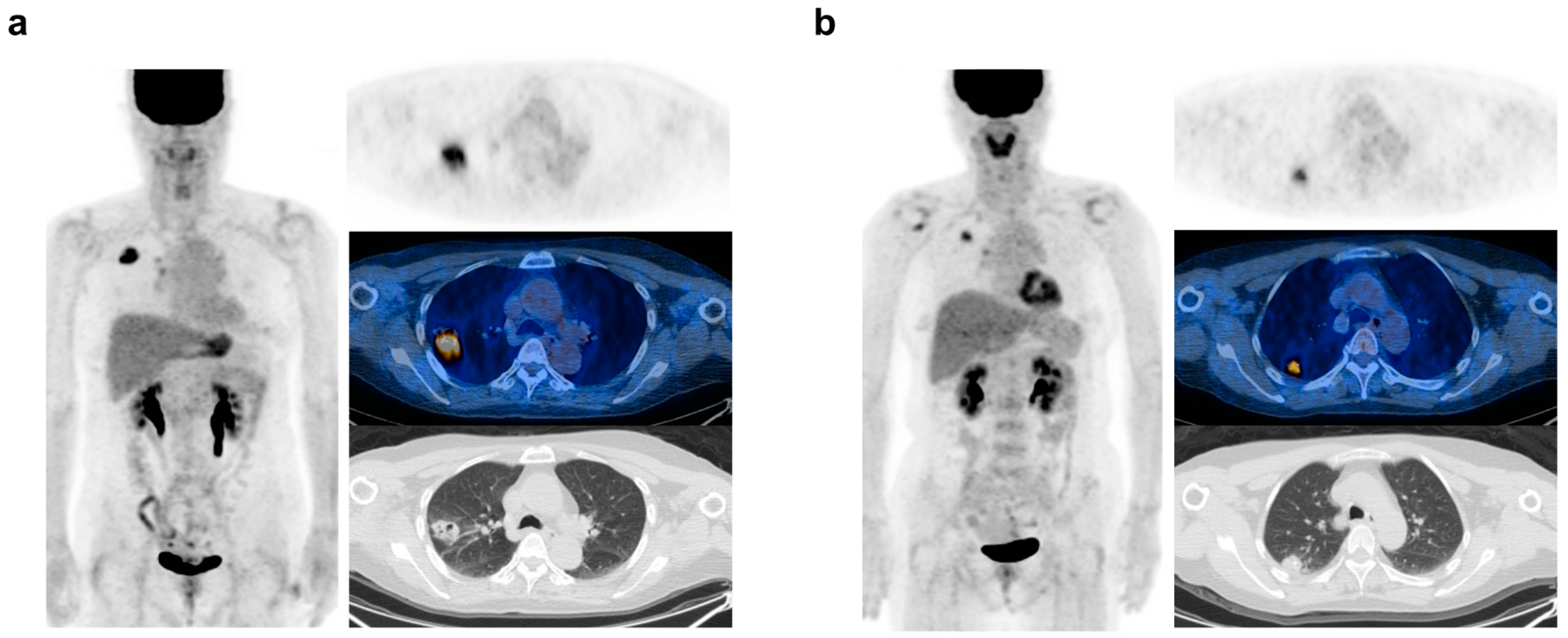 Cancers 16 02525 g004