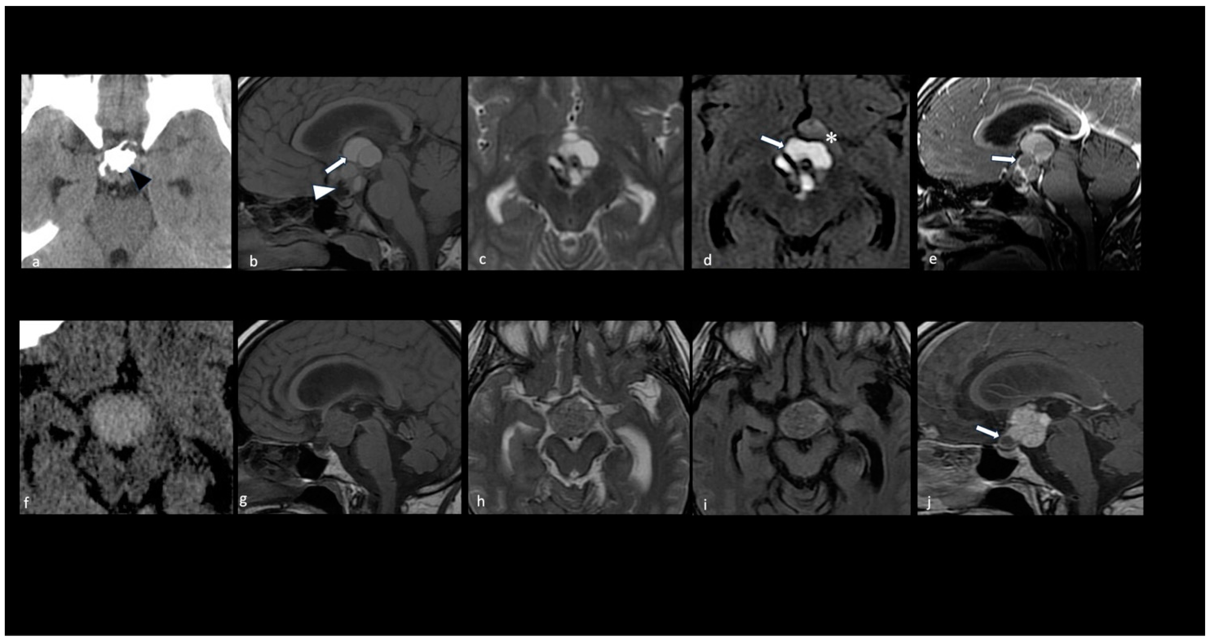 Cancers 16 02532 g004 Cancers 16 02532 g004