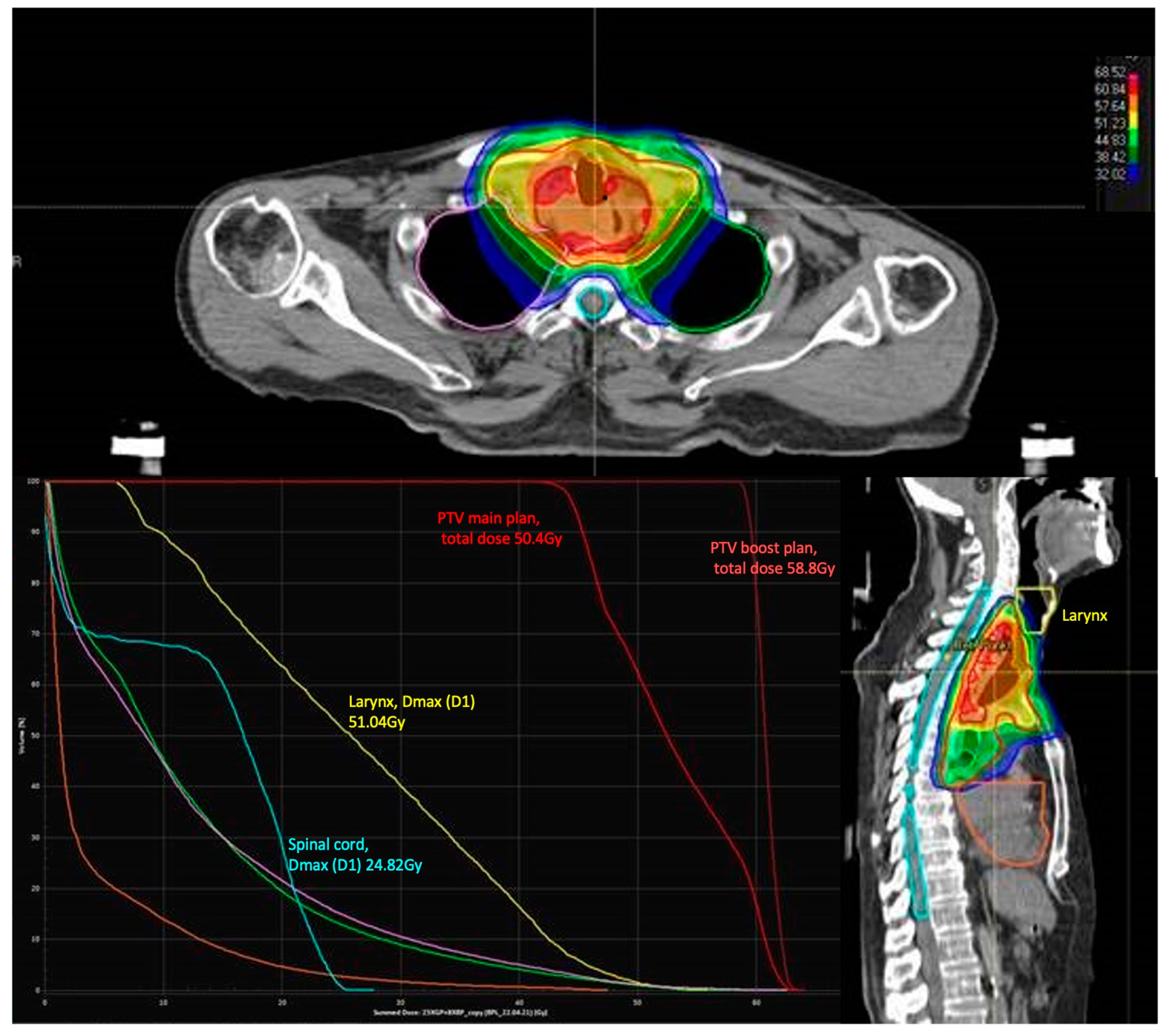Cancers 16 02540 g002