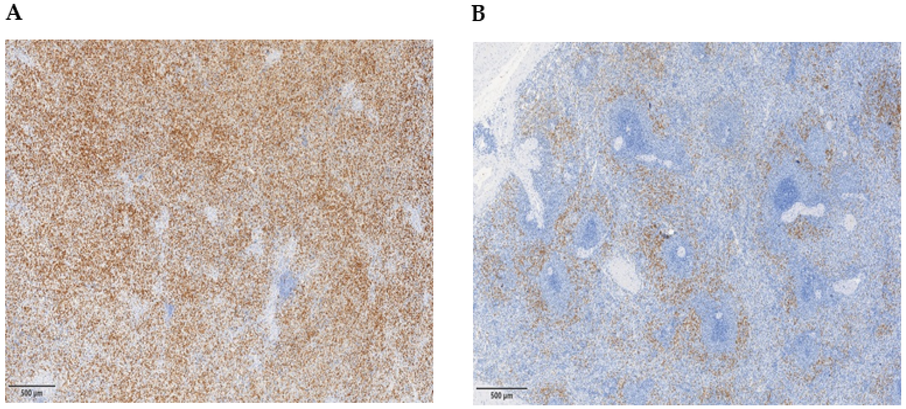 Cancers 16 02556 g004