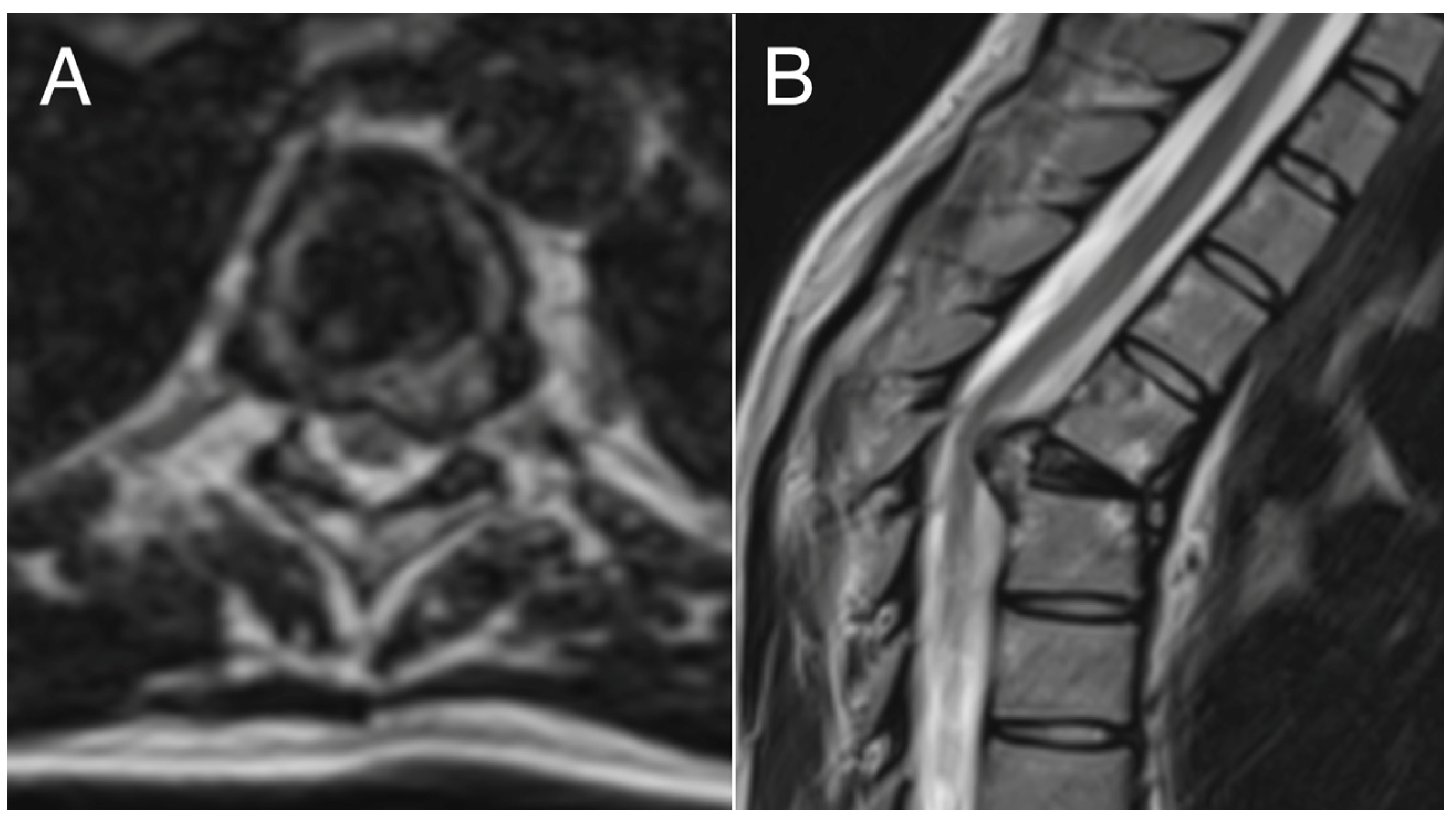 Cancers 16 02557 g003