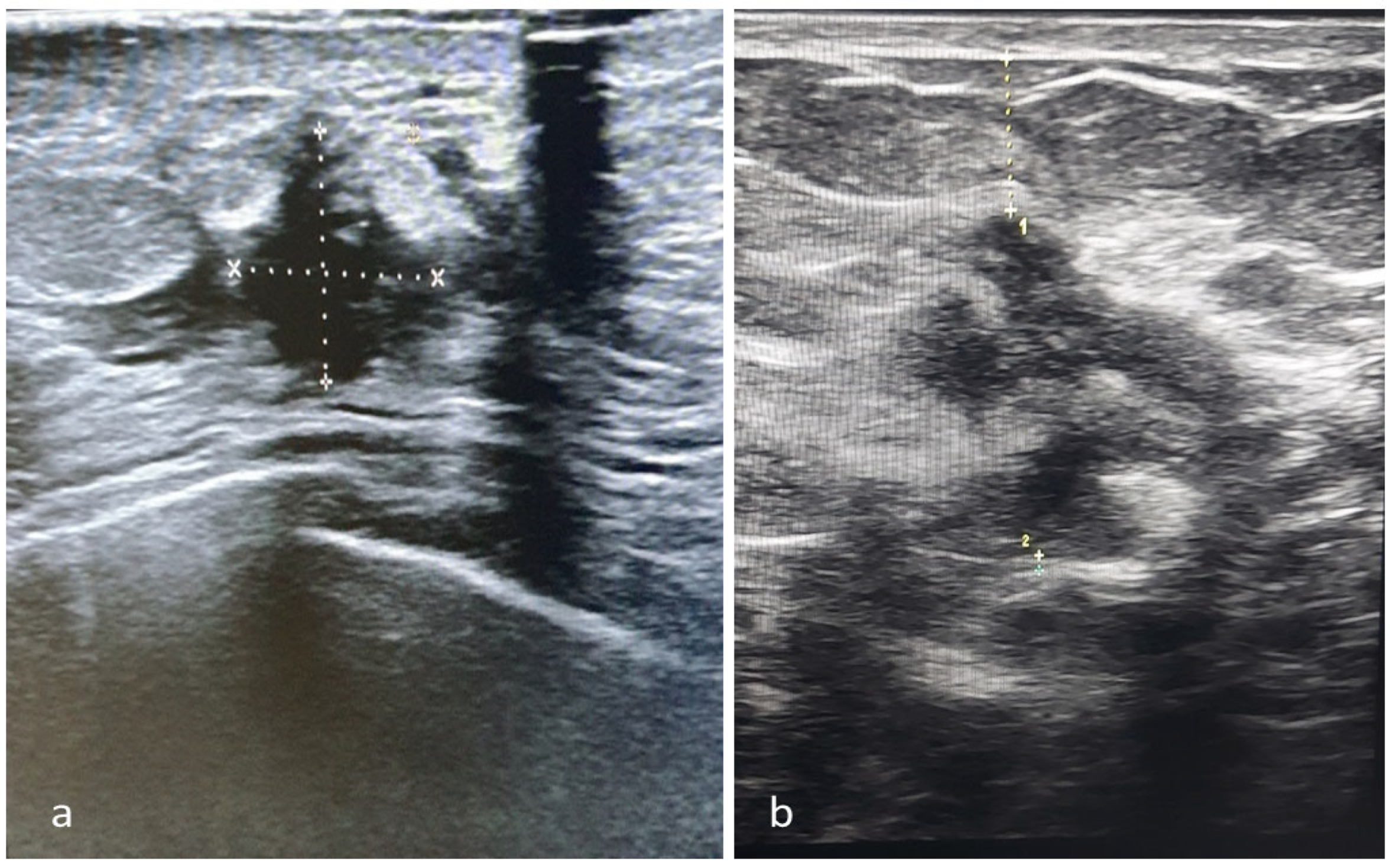 Cancers 16 02564 g003