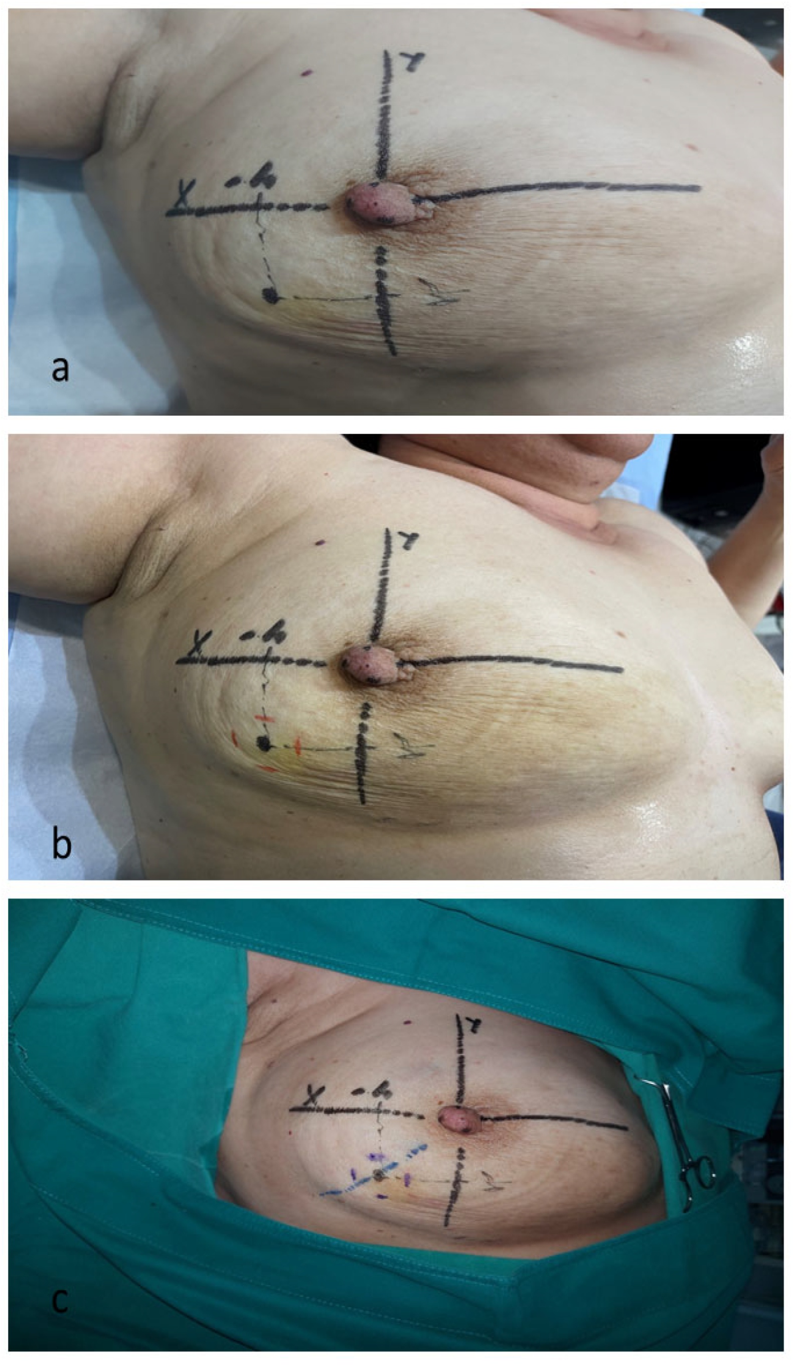 Cancers 16 02564 g004