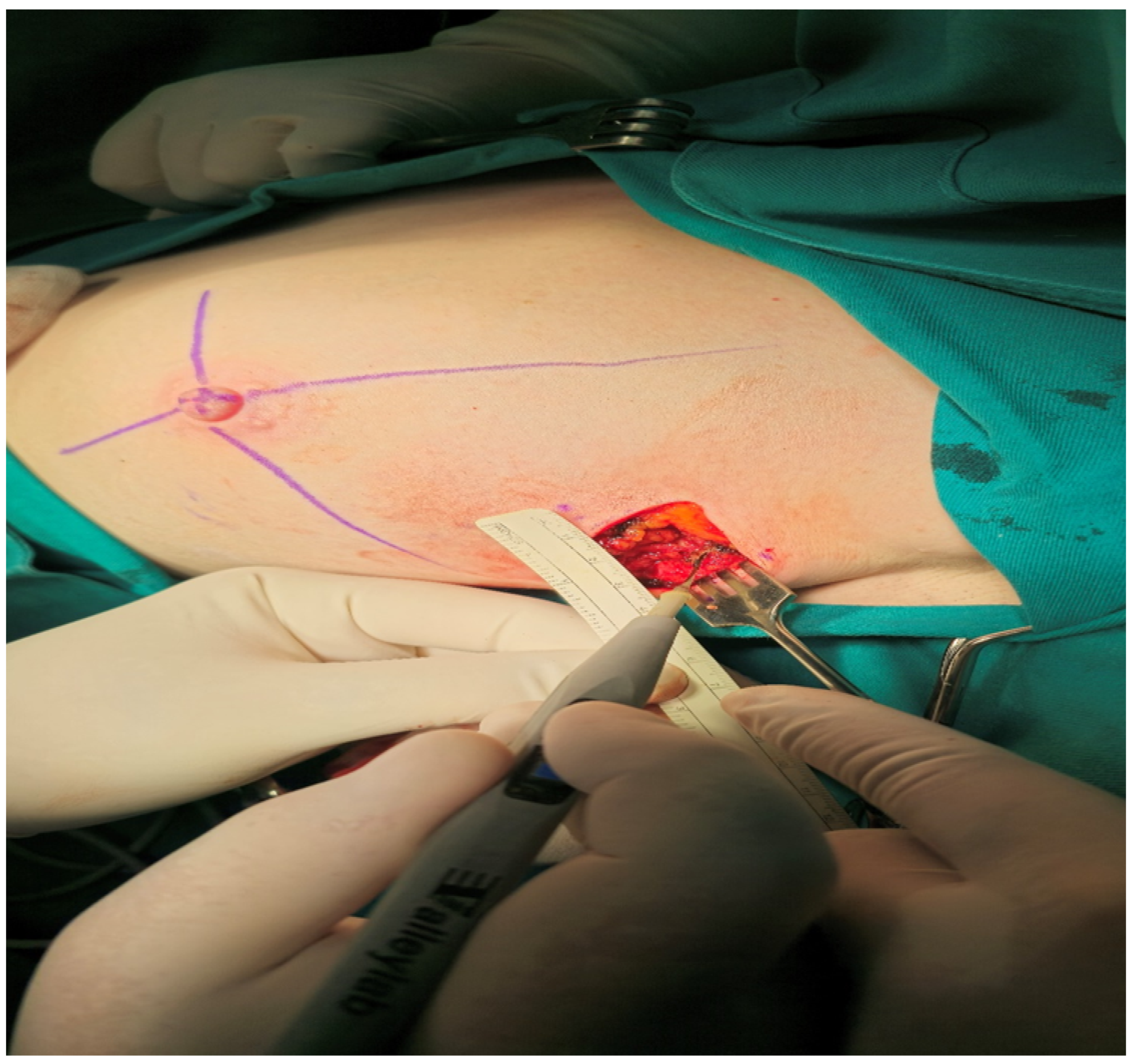 Cancers 16 02564 g005