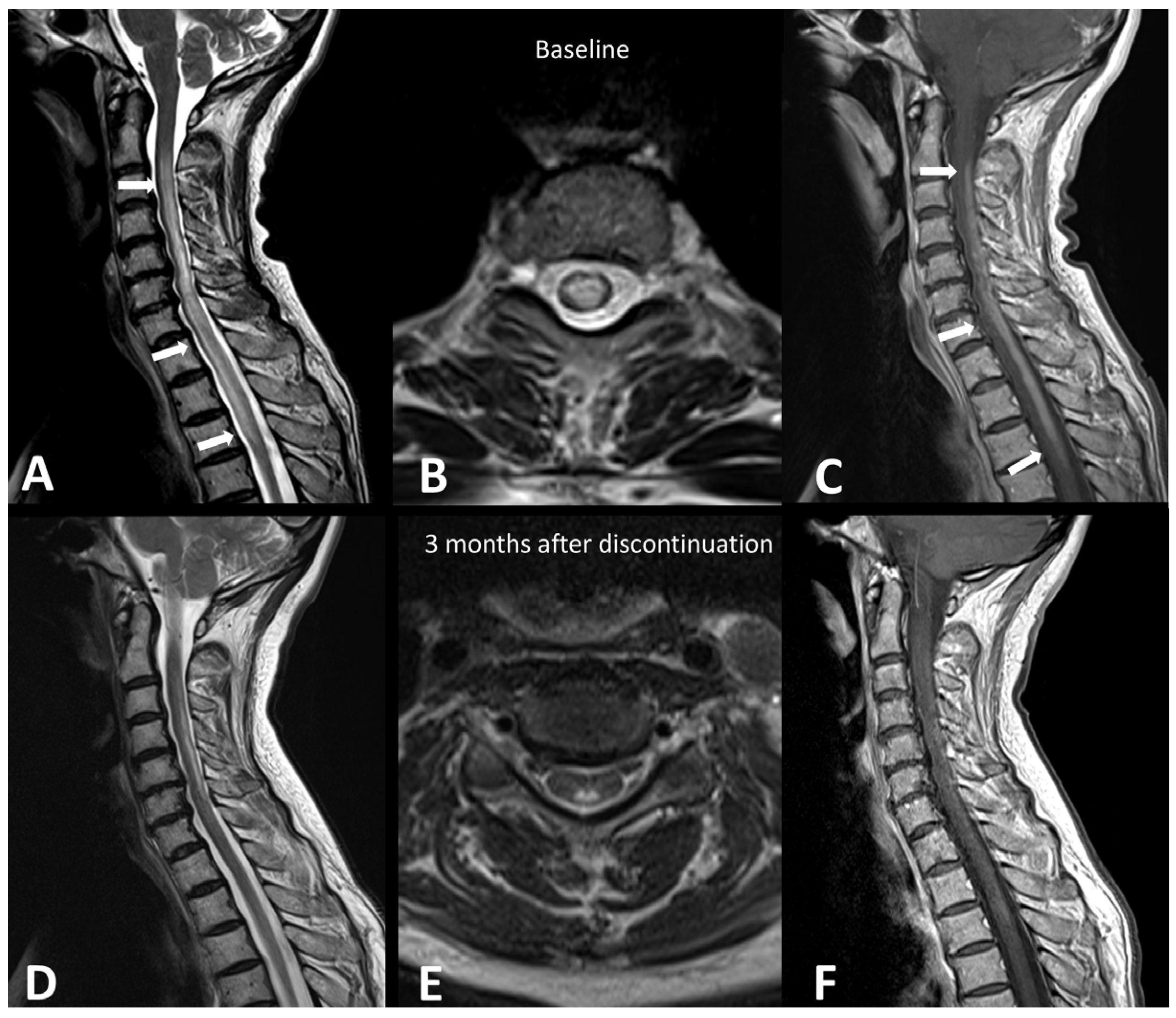 Cancers 16 02585 g001