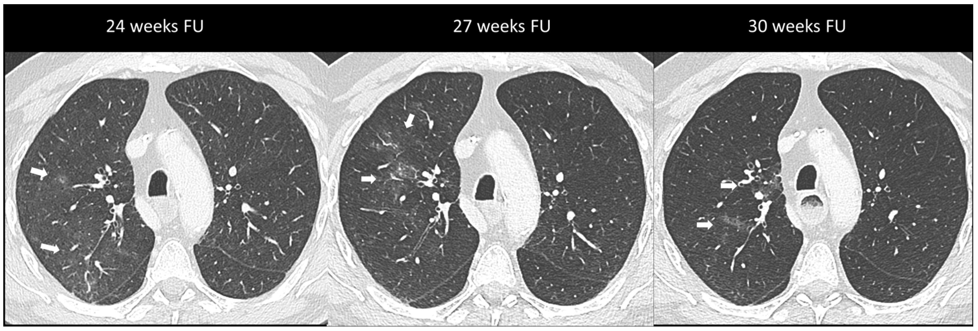 Cancers 16 02585 g003