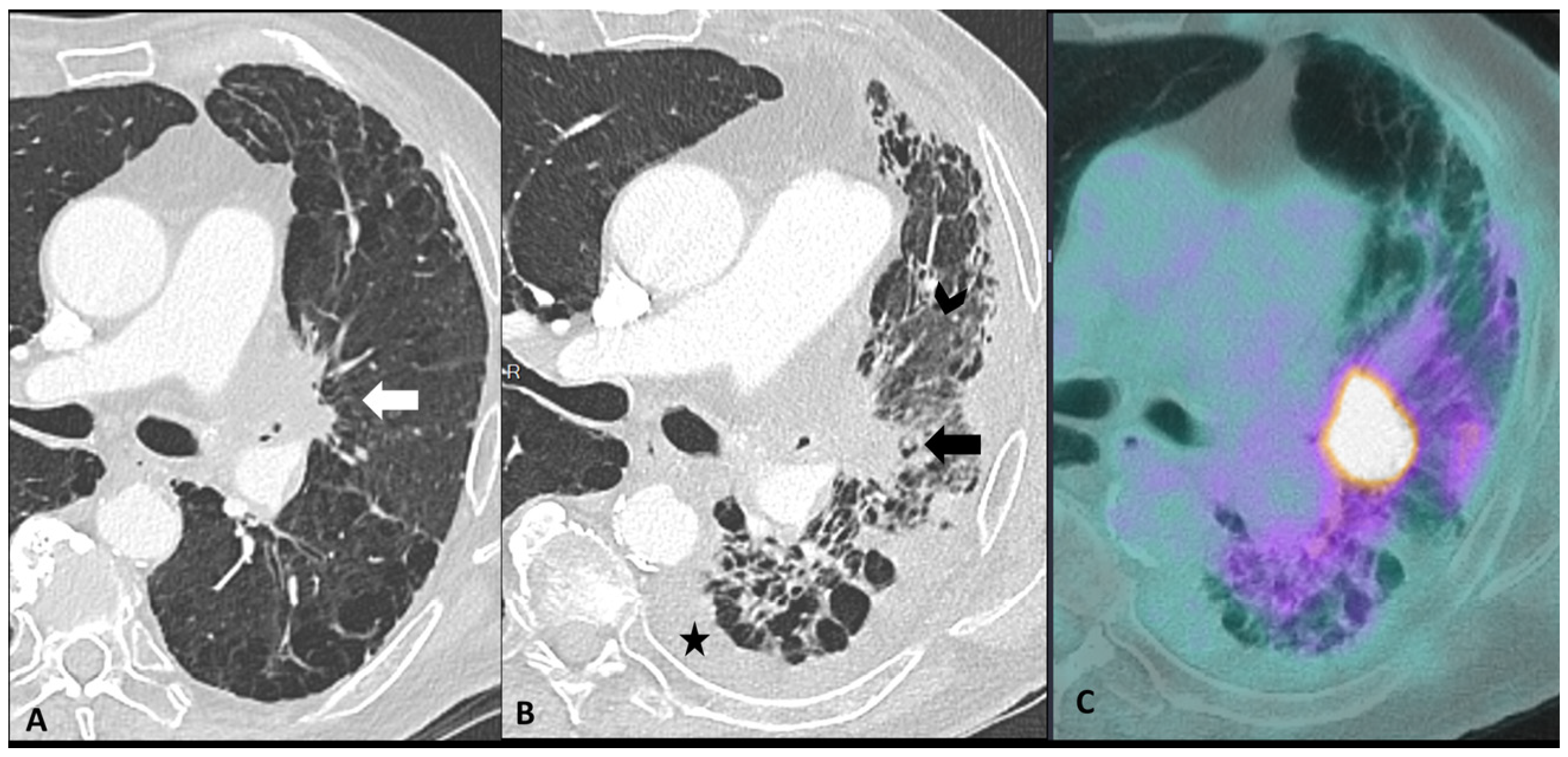 Cancers 16 02585 g004