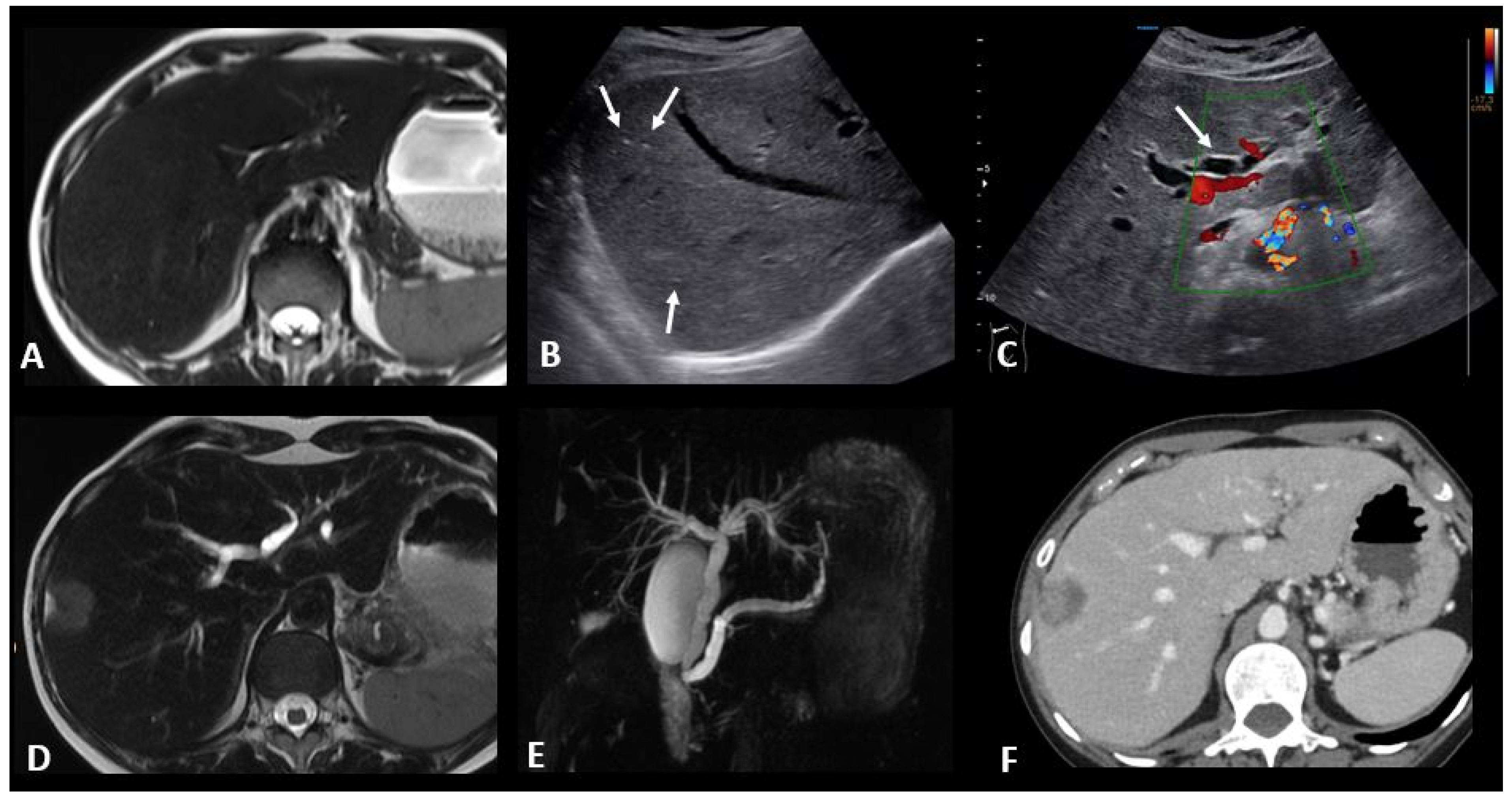 Cancers 16 02585 g008