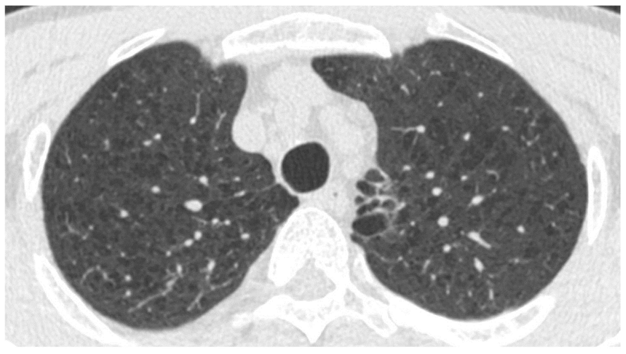 Cancers 16 02600 g003