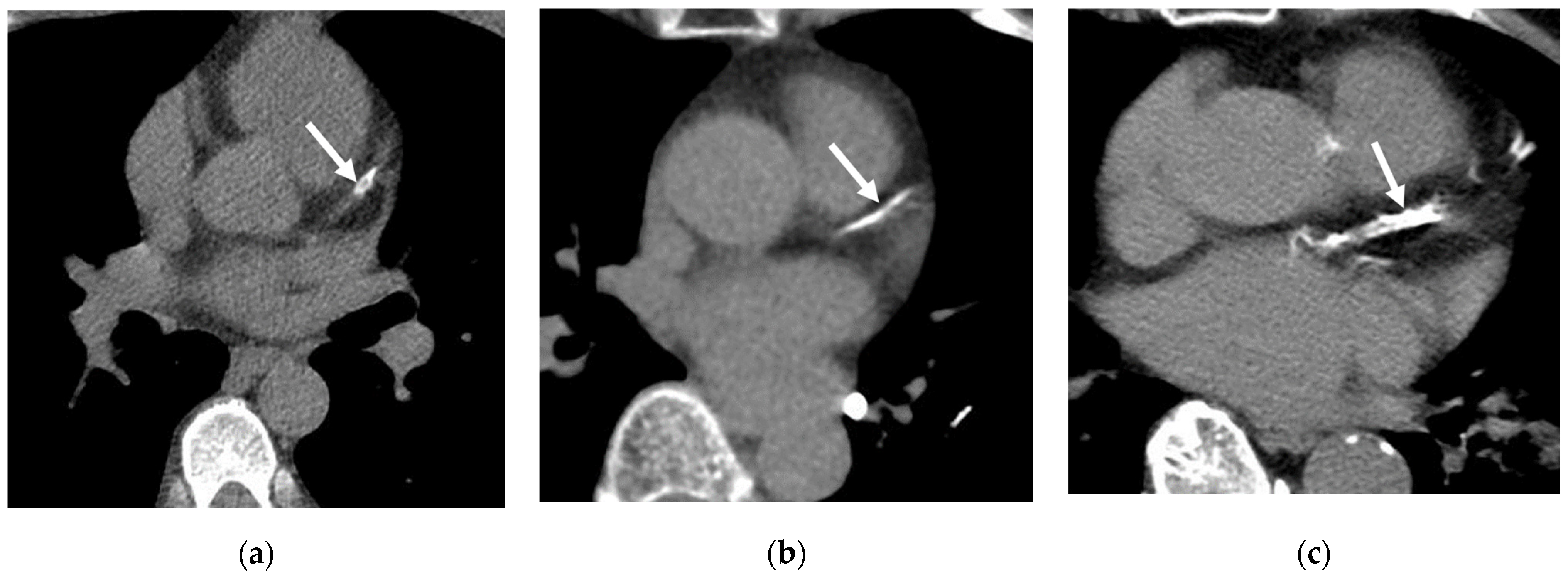 Cancers 16 02600 g005