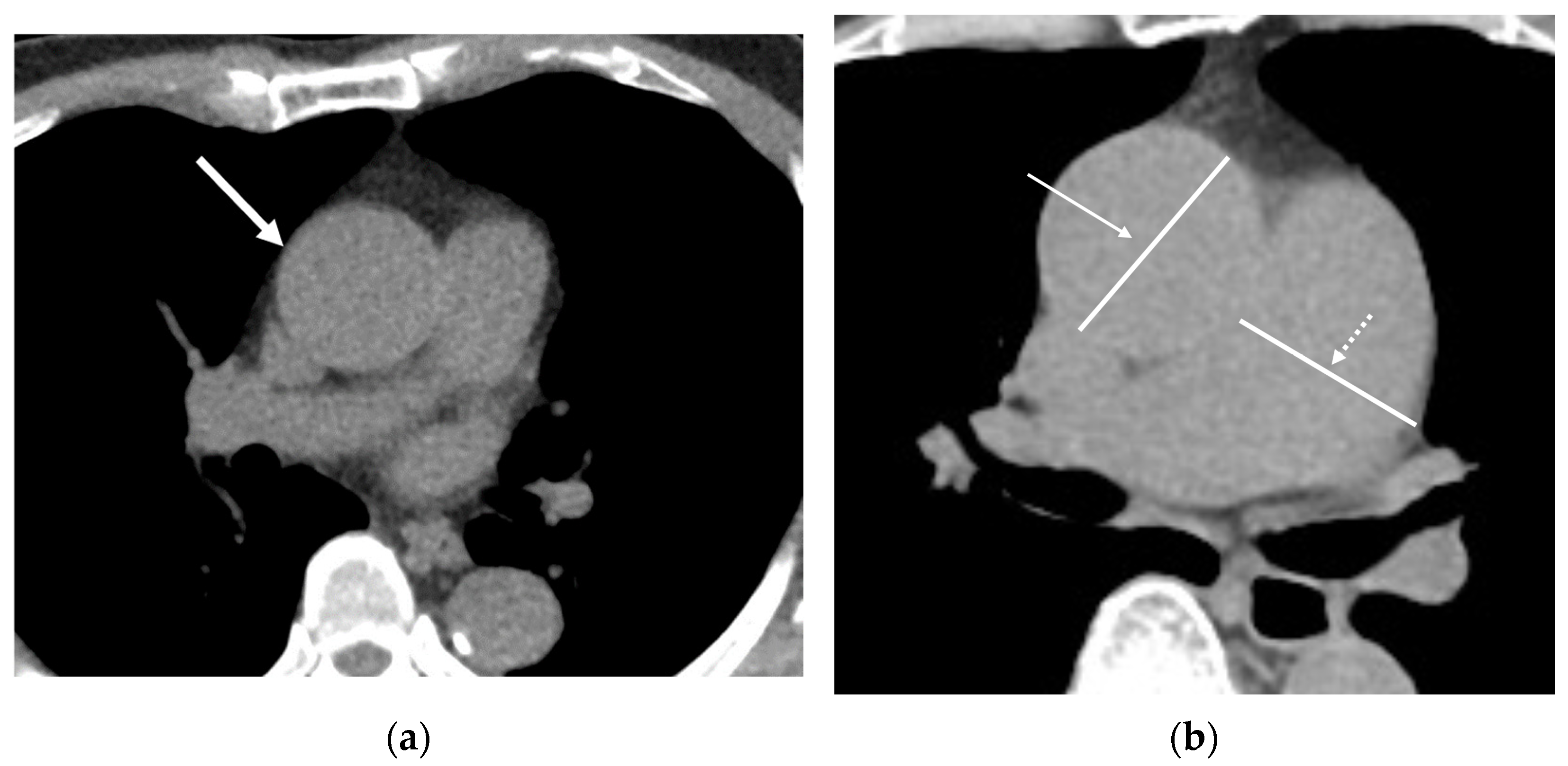 Cancers 16 02600 g006