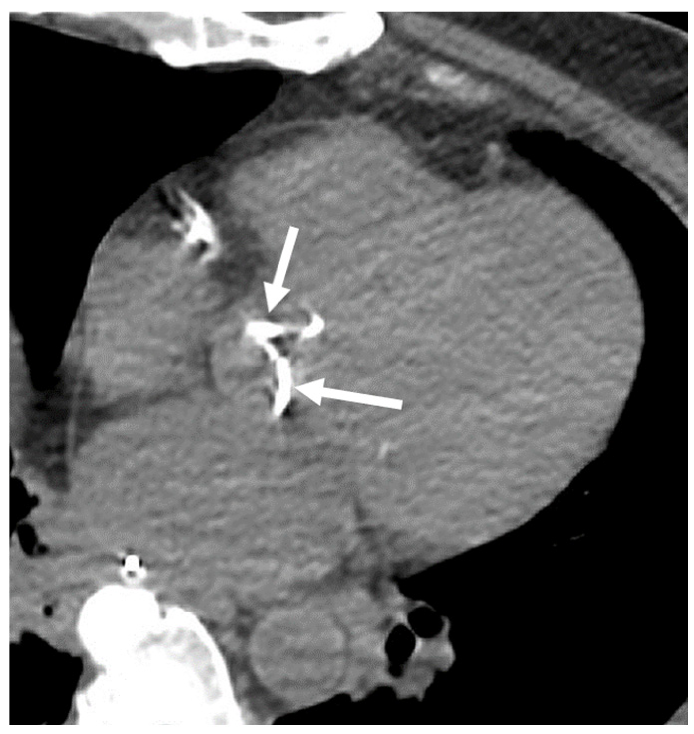 Cancers 16 02600 g007