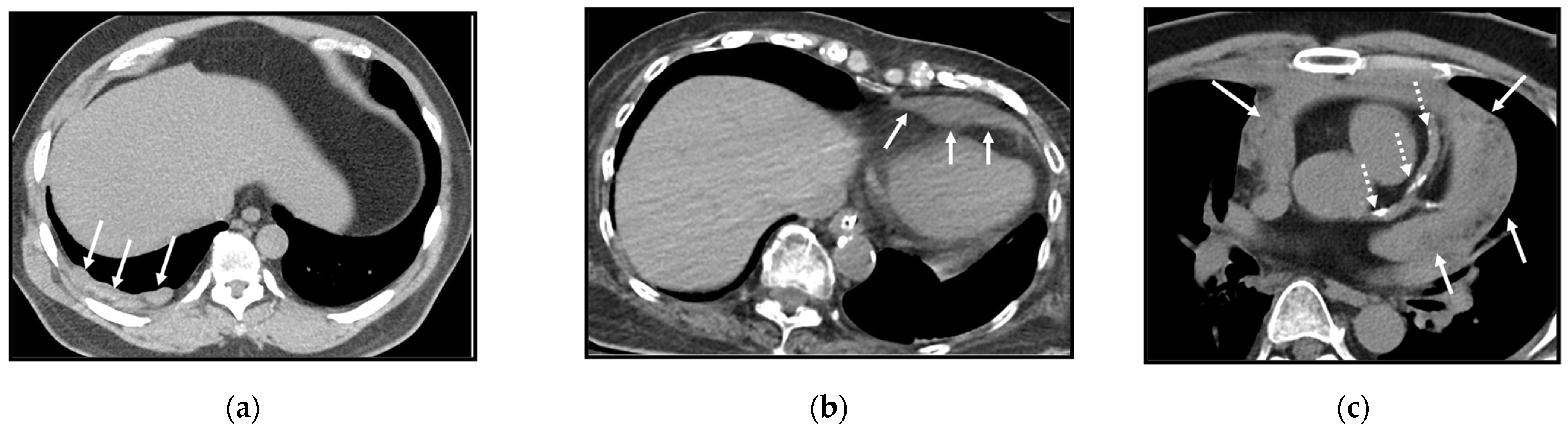 Cancers 16 02600 g008